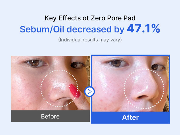 Medicube Zero Pore Pads 2.0, Dual-Textured Facial Toner Pads for Exfoliation and Pore Care with 4... | Amazon (US)