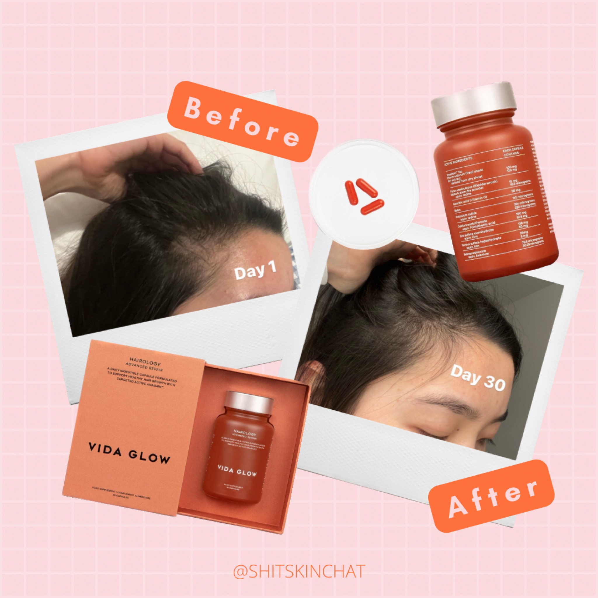 Use ‘SHITSKINCHAT20’ for 20% off. 

#LTKbeauty #LTKunder50 #LTKaustralia