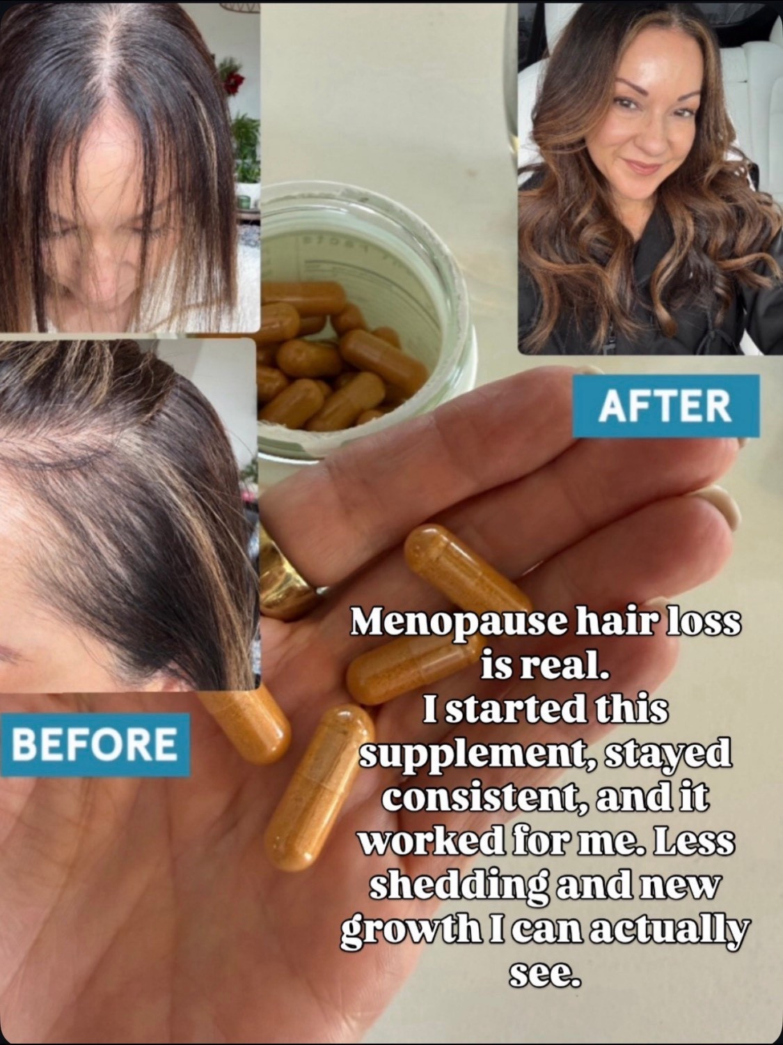 Gamechanger!  This hair growth supplement works! It takes several months of commitment, but my hair is shedding much less and I have so much new hair growth.  I have been taking this for almost a year and I will never stop! 

#LTKOver40 #LTKBeauty #LTKselfcare