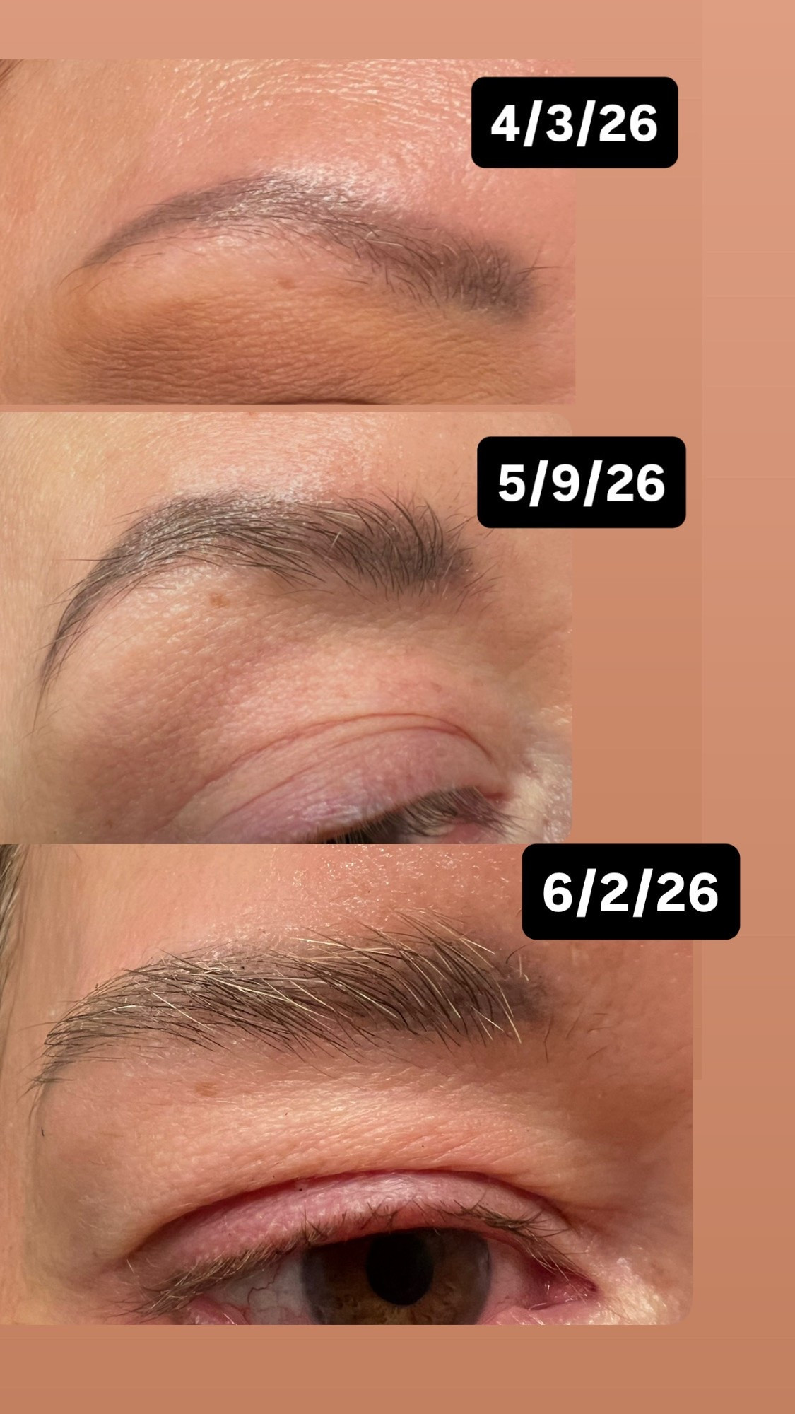 Brow serum.