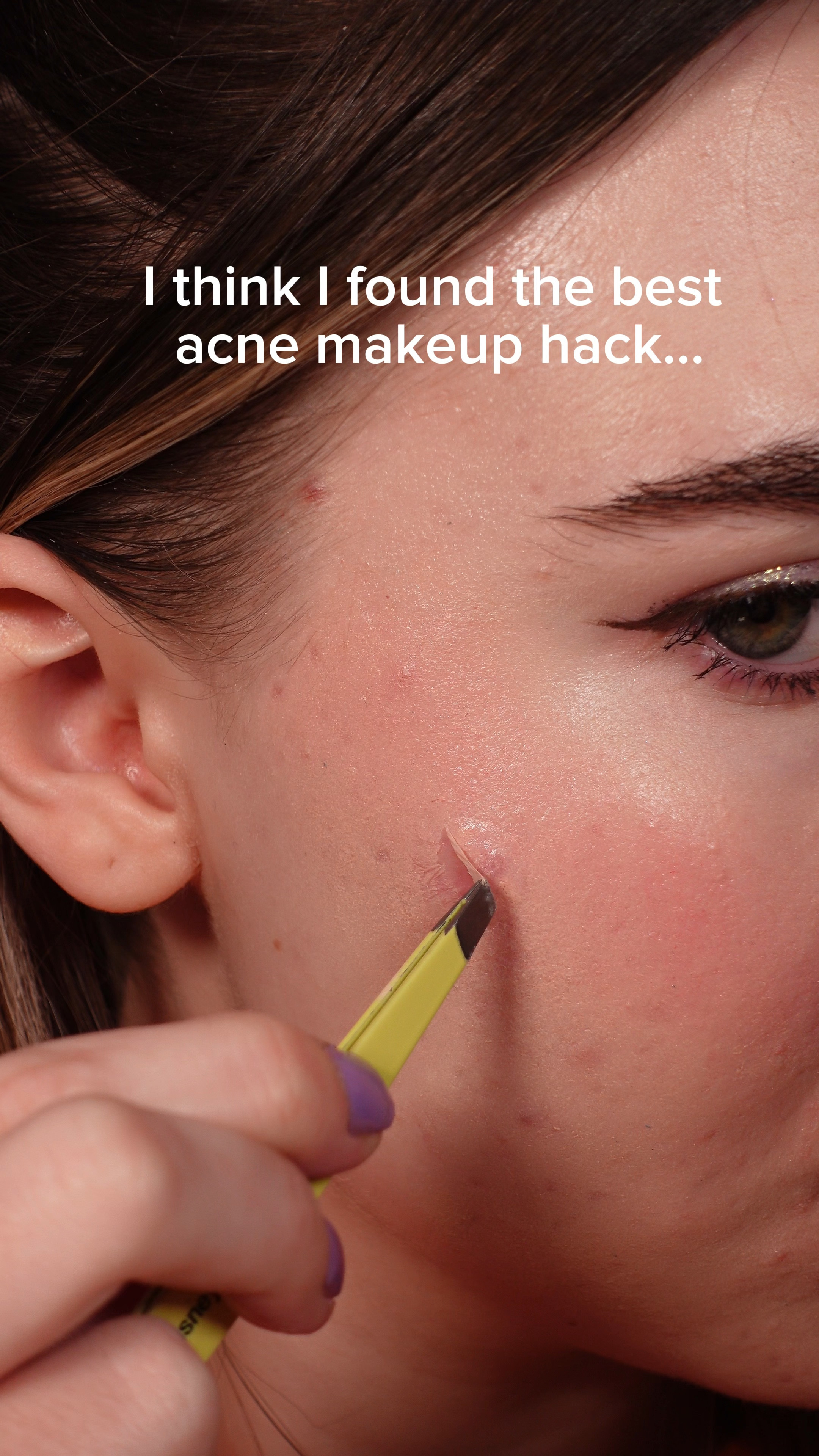 Acne gel for under makeup hack 

#LTKbeauty