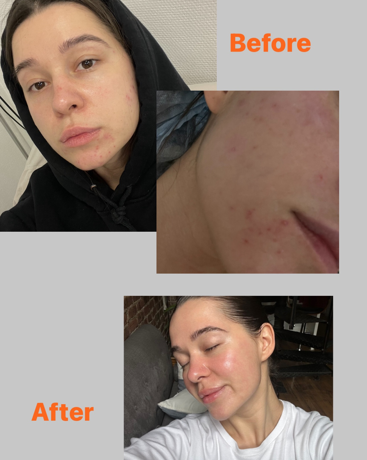 Each morning, I kickstart my day with a warm glass of chlorophyll-infused water. I've found that it's been a major factor in getting my skin to look healthier. This natural antioxidant helps flush toxins out of my body, shields cells from damage, and even gives my immune system a bit of a boost!

Be sure to consult with a doctor before consuming!

#LTKBeauty