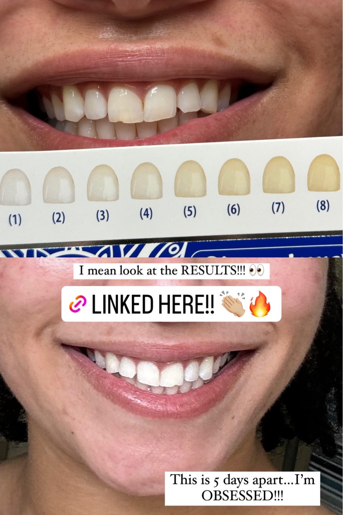 Guru Nanda Teeth Whitening Strips 

#LTKbeauty #LTKfindsunder50 #LTKSpringSale