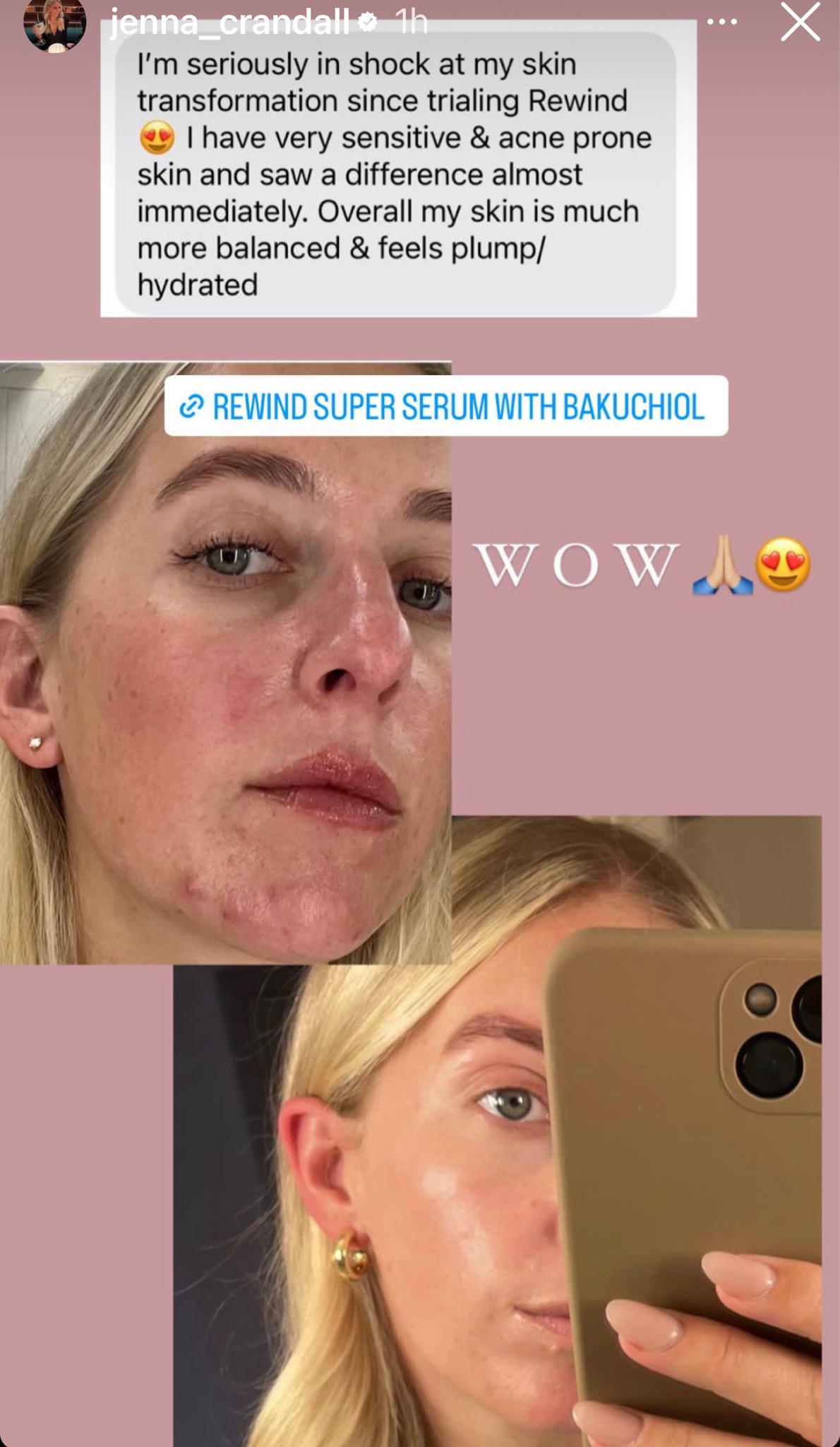 People are loving the retinol alternative serum from BYOS. Get yours during their launch week! So exciting. 
Rewind serum 
Retinol alternative 

#LTKunder100 #LTKstyletip #LTKbeauty