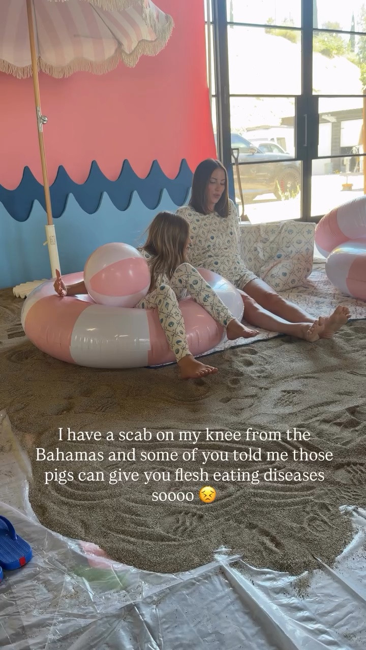 I have a scab on my knee from the Bahamas and some of you told me those pigs can give you flesh eating diseases soooo 😣