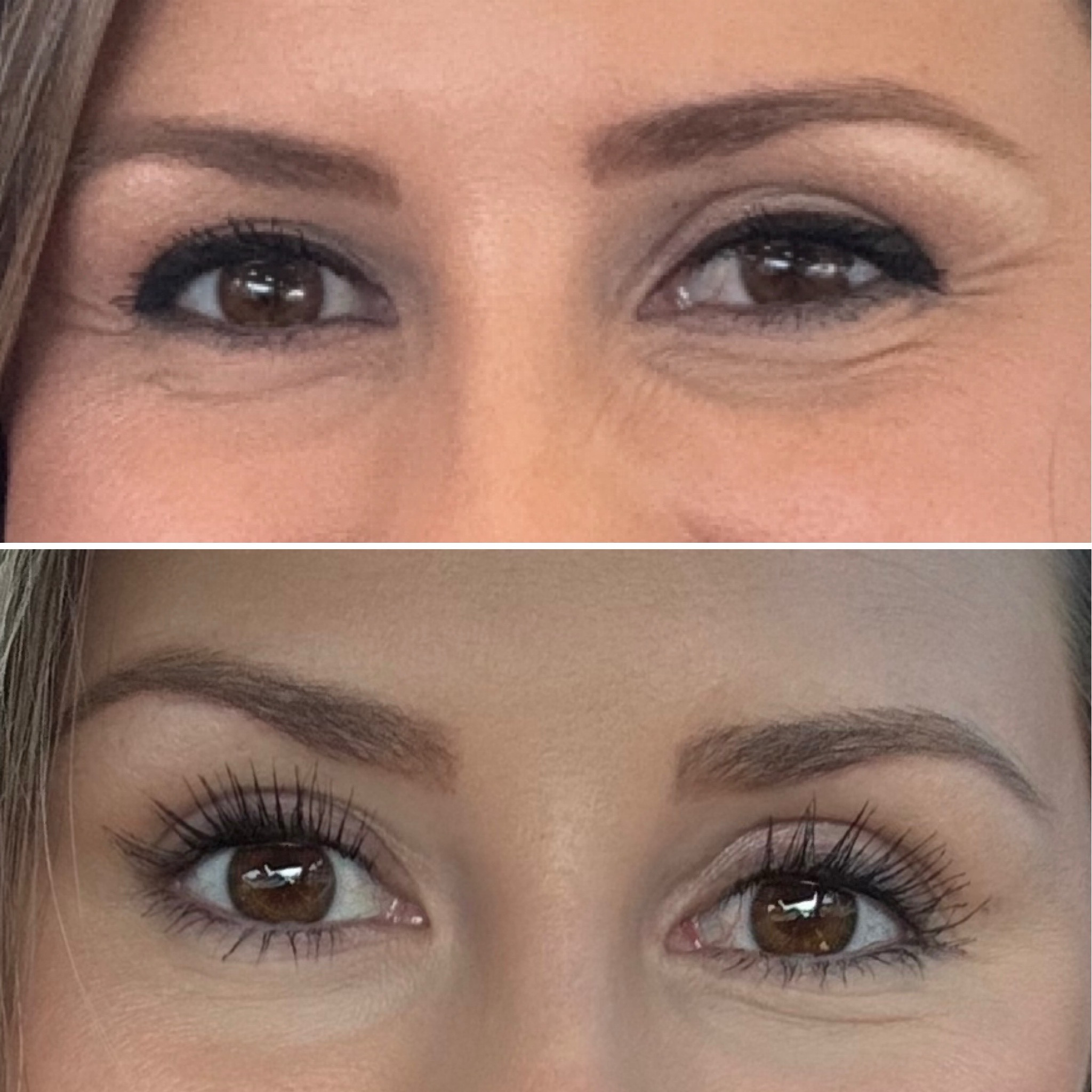 First pic is May 2024 and second is July 2024. This lash serum is so worth the hype!!!!

#LTKSaleAlert #LTKBeauty #LTKFindsUnder50