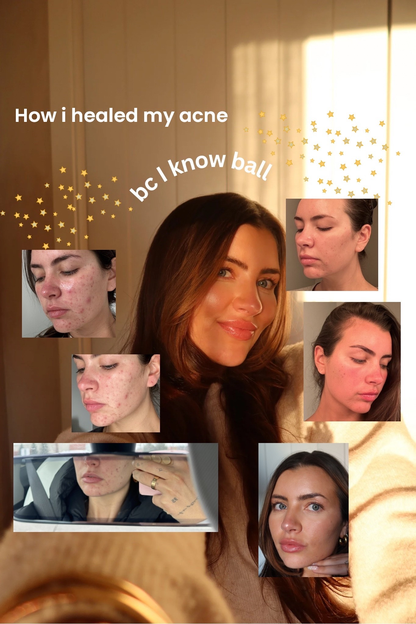 How I healed my acne from the inside out 


#LTKmorningroutine #LTKBeauty #LTKdayinmylife