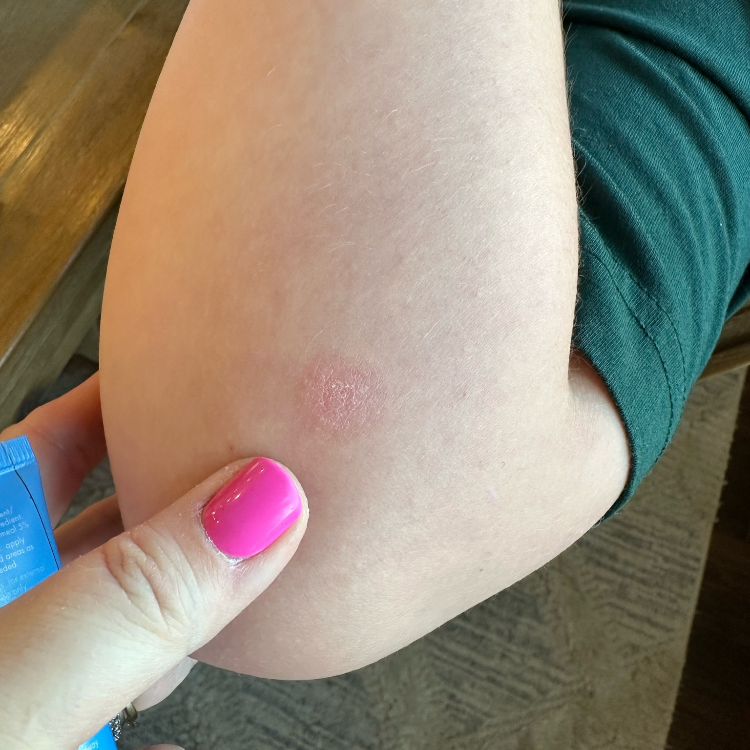 Eczema miracle worker 