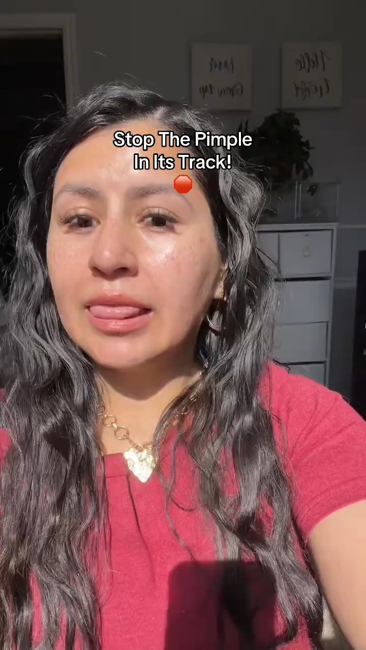 The easiest and most natural way to prevent breakout! 

 #personaldayskincare #personalday #hypochlorousacidspray #acneproneskin #preventacne #LTKselfcare #LTKU #LTKBeauty