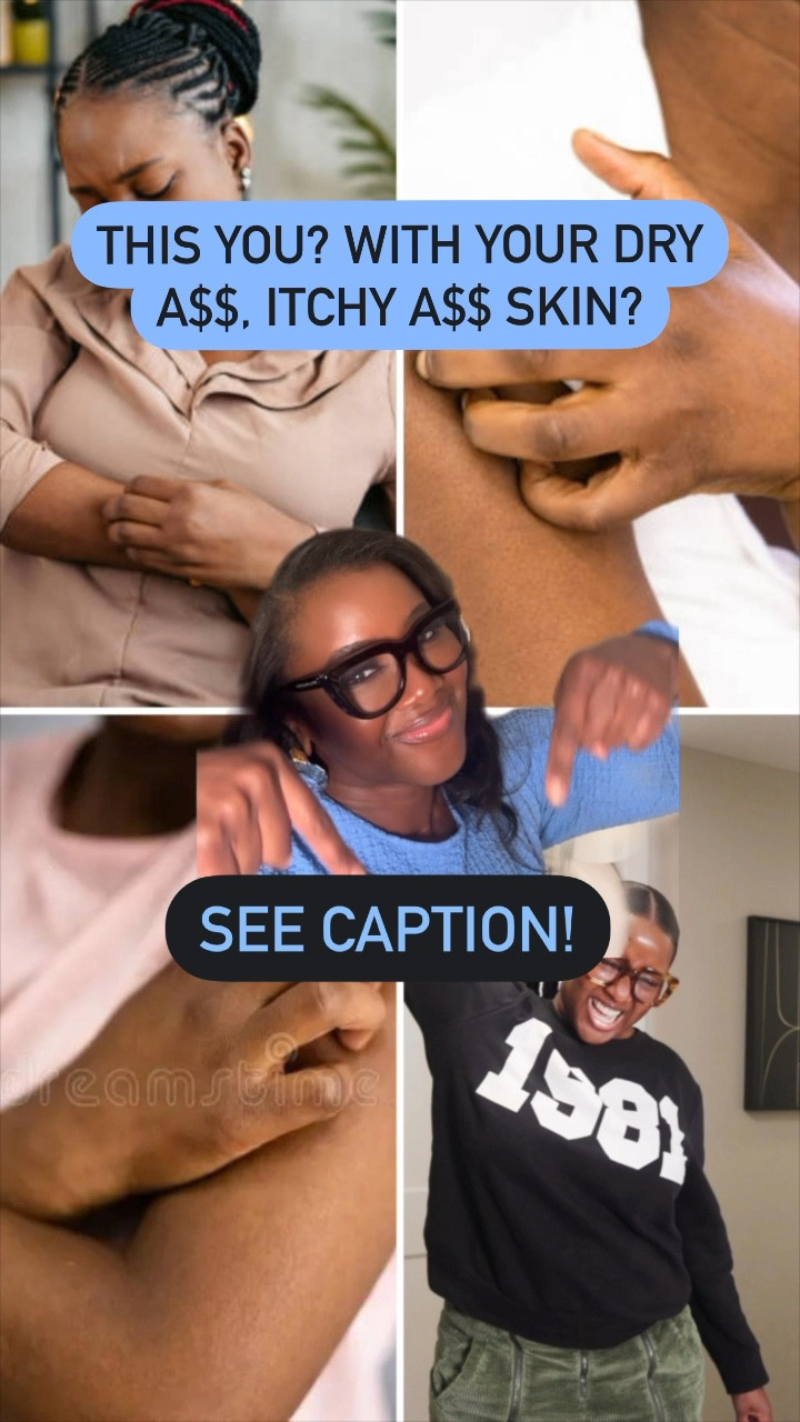 Hey, ashy 👋🏾✨✨ Read this 👇🏾

TOP 🤚🏿THINGS TO DO FOR DRY A$$ WINTER SKIN:

1️⃣ UN-psycho your shower routine and turn down that hell hot water 

2️⃣ Use a winter-appropriate body wash. Comment LINKS and you’ll get some options sent straight to your DM.

3️⃣ Moisturizer your skin after a shower while its still a little damp with a winter-approved moisturizer. Comment LINKS to have some options sent to your DM.

Also consider sealing your moisturizer with a layer of Vaseline or Aquaphor for extra protection.

4️⃣ Use a humidifier! Indoor heating can be super drying on skin.

5️⃣ Avoid itchy fabrics like wool—or at least use a silk or satin lining in between to protect your skin

⚠️ If you’re not getting relief after this, call your derm 🧑🏾‍⚕️👨🏾‍⚕️

#LTKfindsunder50 #LTKSeasonal #LTKbeauty