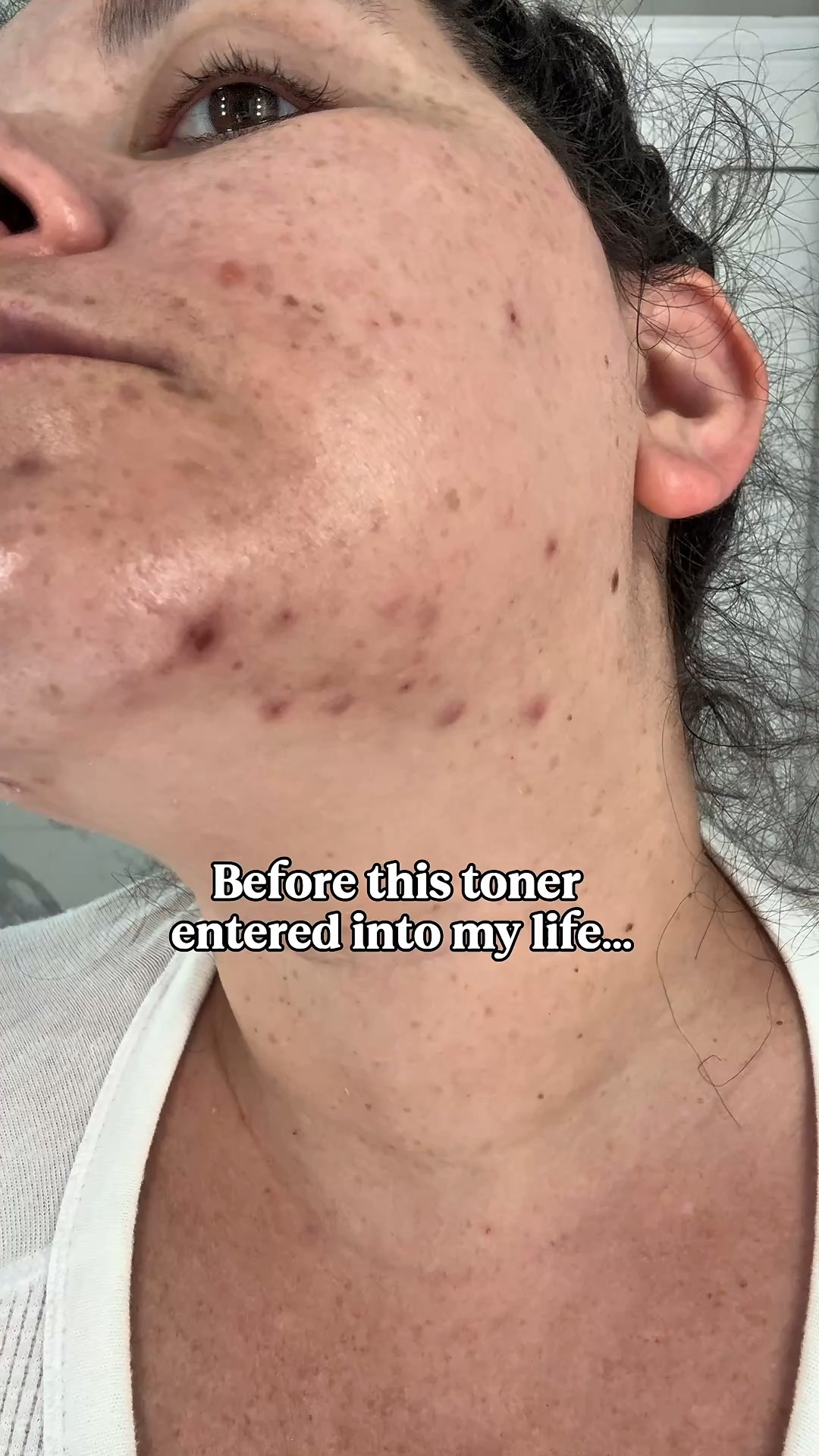  I have been using this
@PURITO SEOUL Oat PDRN Gentle Refining Toner for a while now. It's perfect for acne prone skin and it's really been helping clear it up. It refines your skins texture, deeply hydrates, and clarifies skin tone. You can grab through my @LTK or Amazon #Purito #OATPDRNTONER #acnetreatment #acneproneskin #tonerforacneproneskin

#LTKBeauty #LTKFindsUnder50