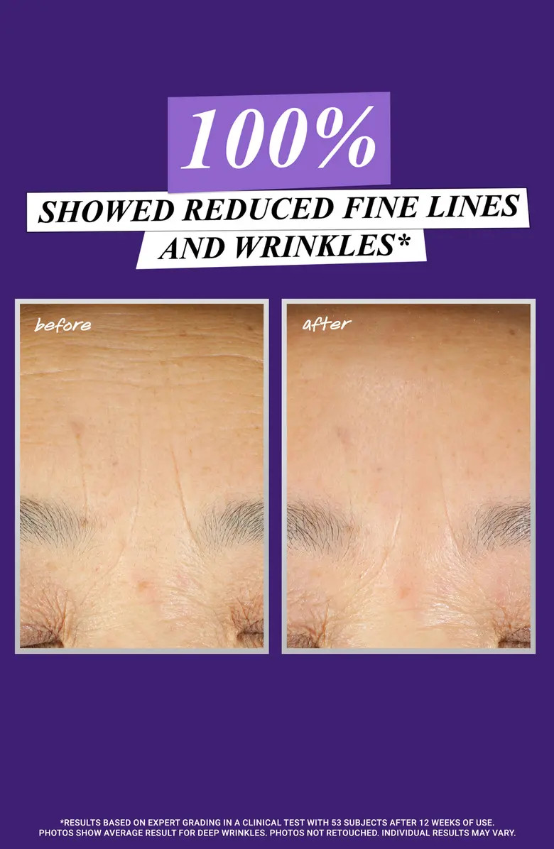 Retinol Skin-Renewing Daily Micro-Dose Facial Serum | Nordstrom
