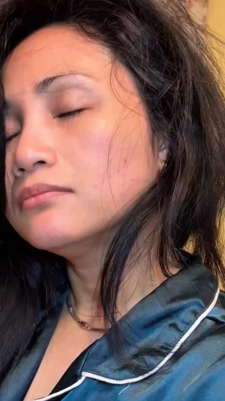 Woke up with pillow marks? This is my morning skin reset with the Medicube NAD serum ✨#medicube #egfnadserum #antiaging @medicube_global_official #skincare #koreanskincareroutine