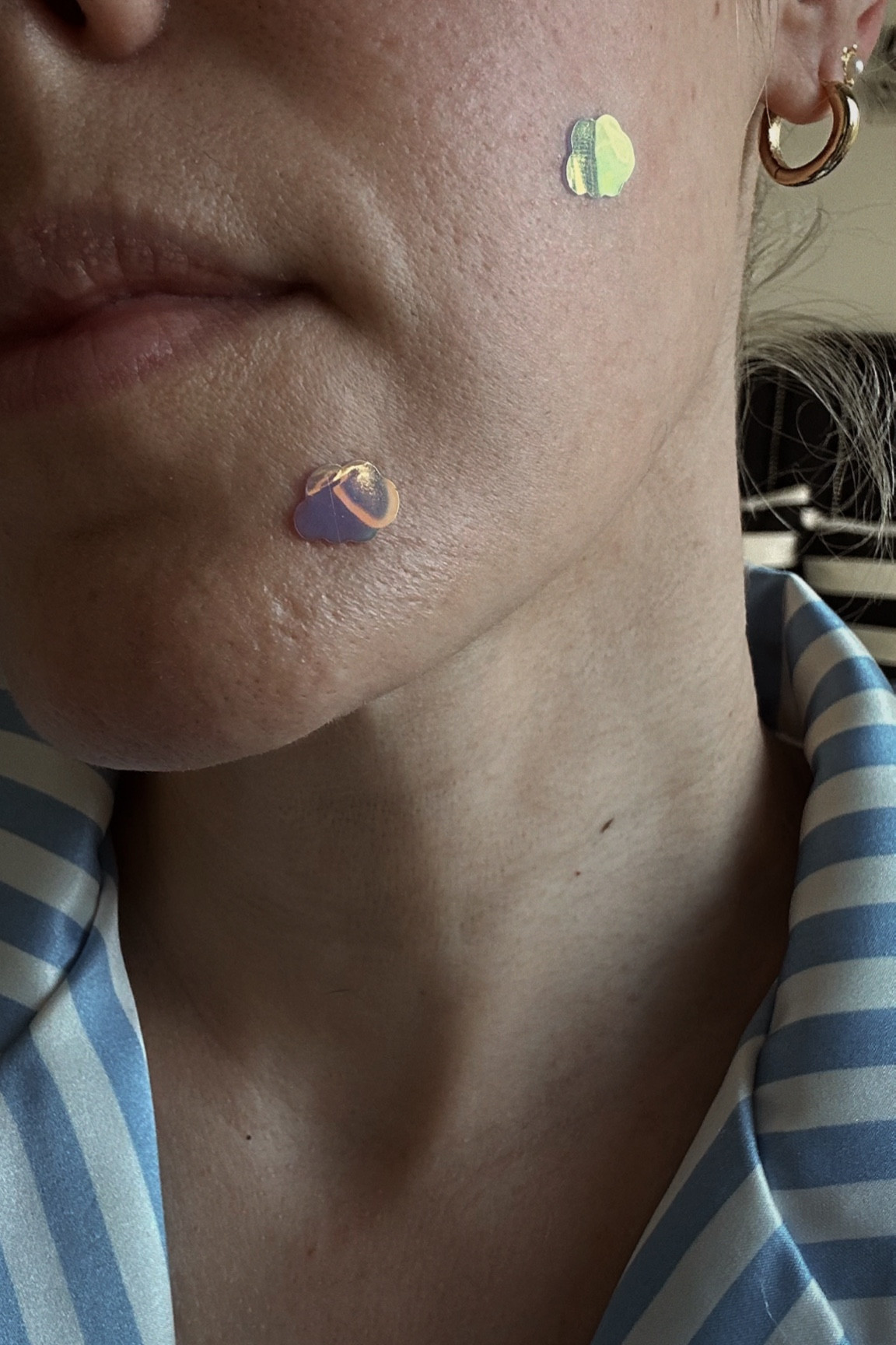 Holographic acne patches, zit patches, blemish, striped pajama set under $30

#LTKBeauty #LTKFindsUnder50