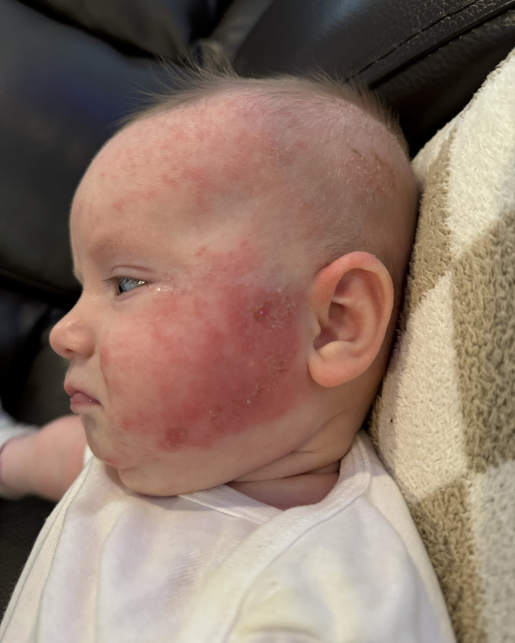 The ONE thing that helped heal my baby’s eczema 🙏🏻

#LTKBaby #LTKKids #LTKBeauty