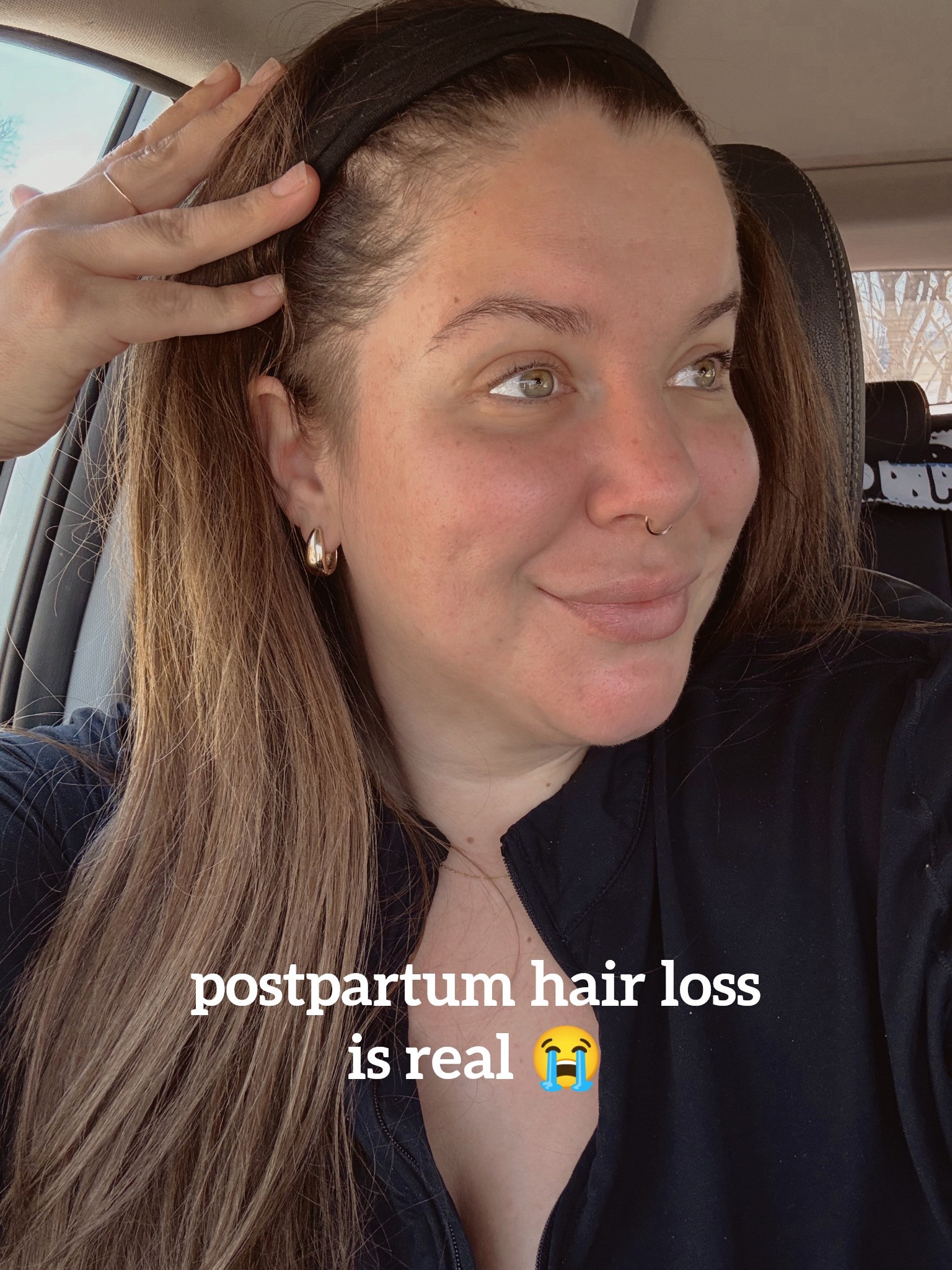 i got OVERWHELMING amounts of responses to my quest for postpartum hair loss products and attached are the products mentioned! 

#LTKBeauty #LTKBaby #LTKStyleTip
