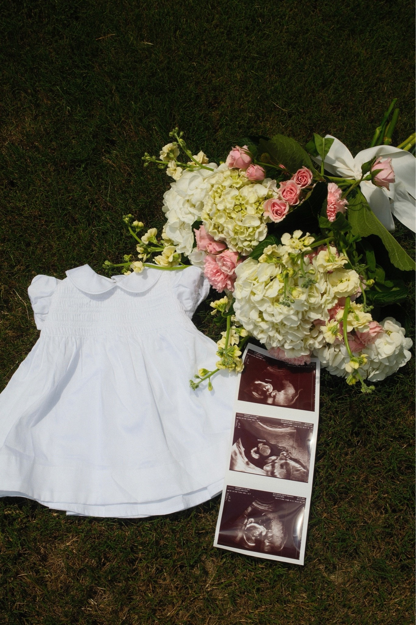 Baby girl on the way 🩰🎀💕

#LTKBump #LTKBaby #LTKKids
