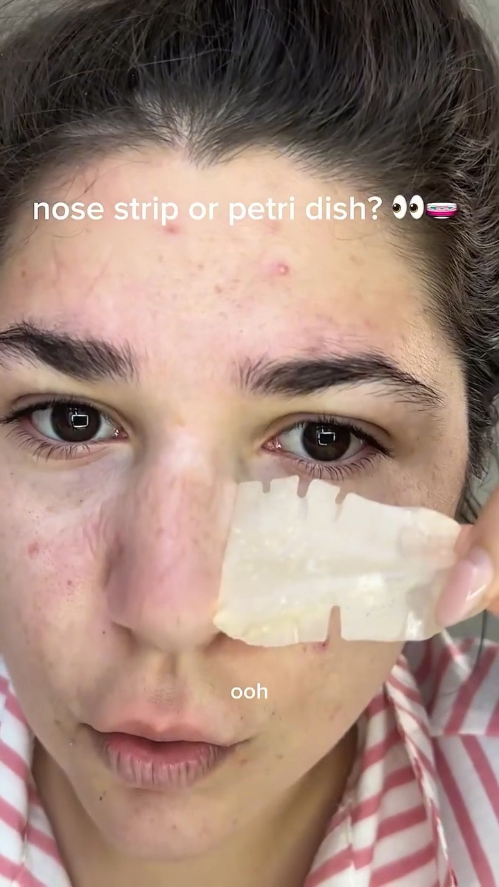 A @peach_slices nose strip has not disappointed me yetttt wow someone call bill nye 😝

#acneproneskin #acnejourney #pimplepopping #pimplepatches #pimplepatch

#LTKselfcare #LTKmorningroutine #LTKBeauty