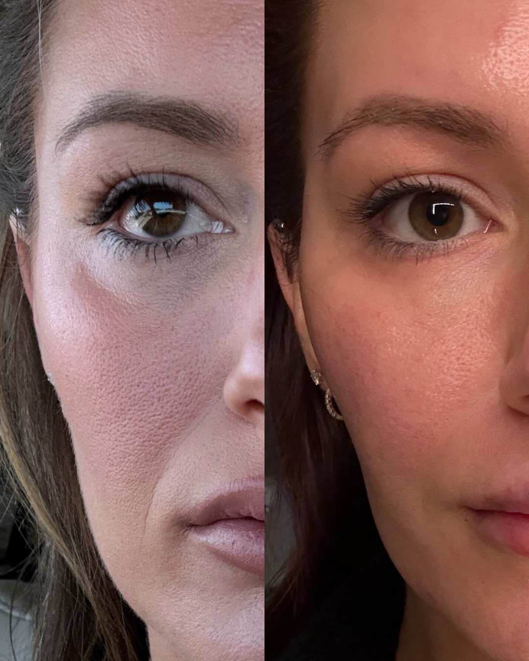 I’m a board certified nurse practitioner/aesthetic injector & this isn’t just Botox. 

It’s a good, consistent, skin care routine 🙌🏻

#LTKselfcare #LTKmorningroutine #LTKBeauty