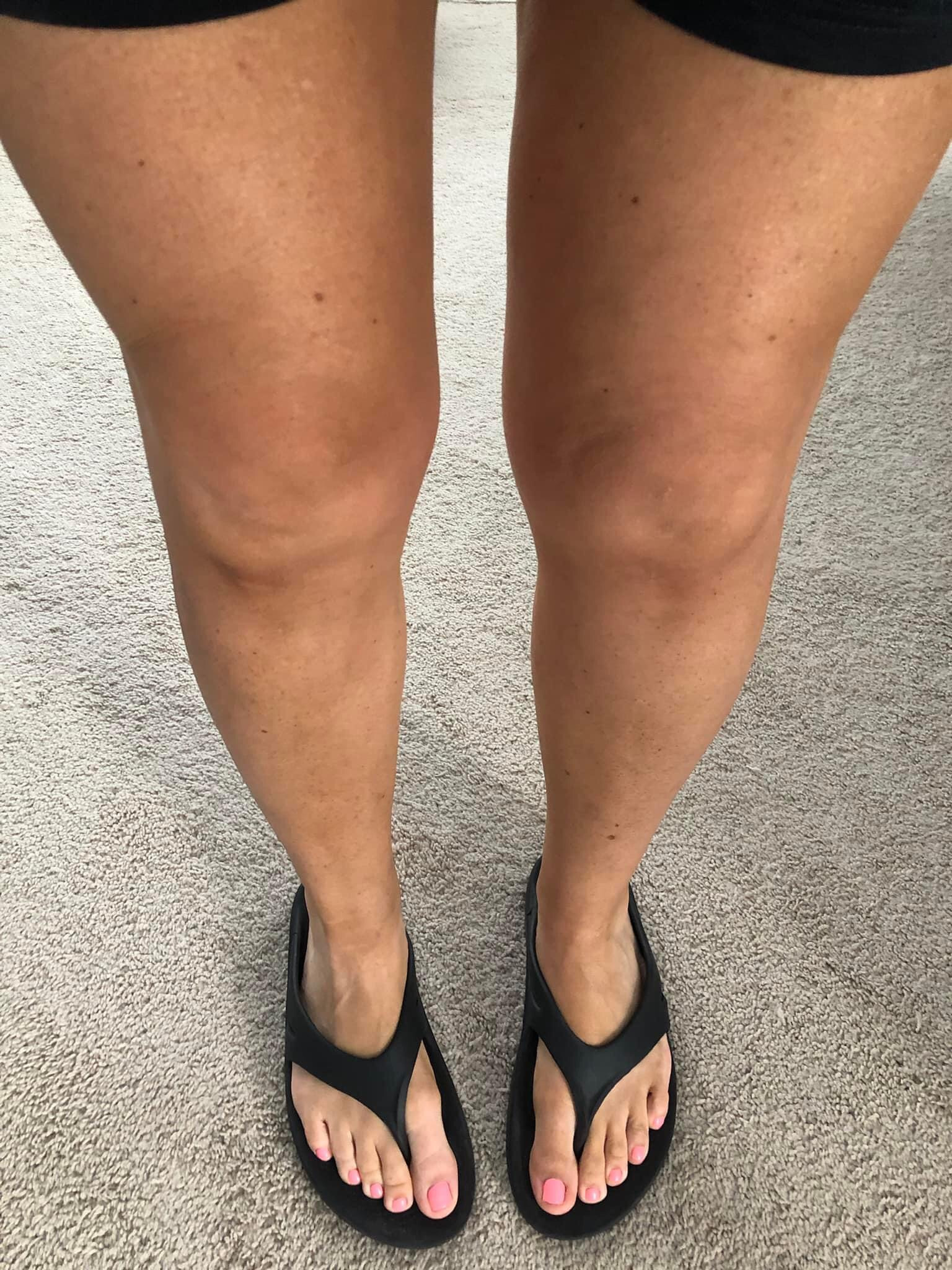My favorite sunless tanner. I grabbed ultra dark, and it looks so natural in person. No streaking. No transfer. No stinky smell! 

#LTKmidsize #LTKtravel #LTKover40

#LTKBeauty #LTKSwim #LTKOver40