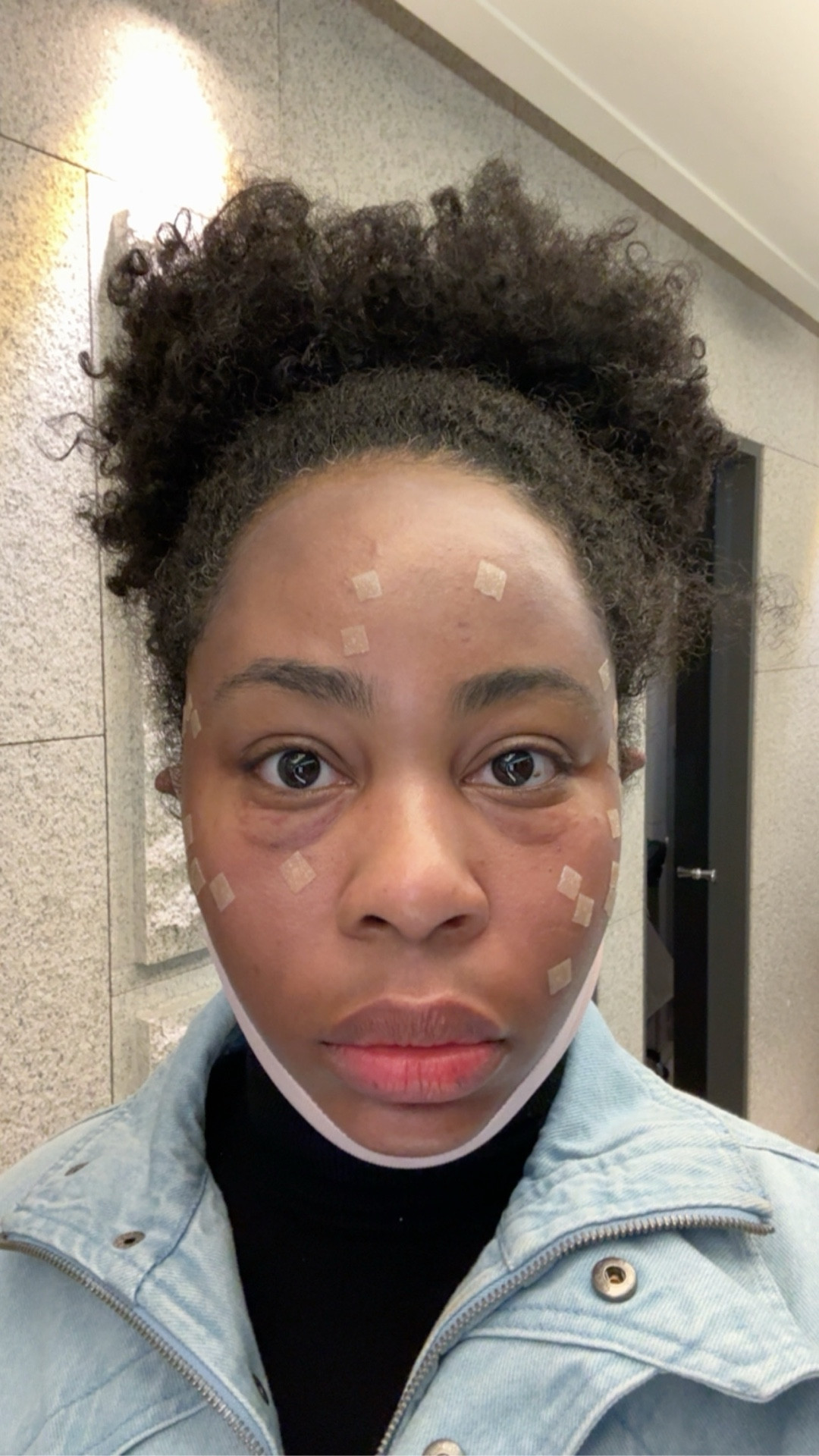 Real life test: can a concealer cover actual bruising? 👀

After my skin treatments here in Korea, I’ve been dealing with noticeable under-eye bruising/black eyes while I heal. And instead of waiting it out off camera, I wanted to see what would actually make me feel more like myself again… so I tested the NARS Soft Matte Complete Concealer.

When I say this surprised me… I mean it.

This isn’t just “cute coverage”—this is full, corrective coverage. It visibly neutralized the darkness and bruising under my eyes without looking heavy or cakey. I didn’t have to pile on layers, and it still looked like skin.

If you struggle with:
• dark circles
• hyperpigmentation
• post-treatment bruising
• uneven under-eyes

…this is one of those products that actually does what it claims.

✨ What I noticed:
– A little goes a long way
– Buildable but already full coverage on first application
– Soft matte finish that doesn’t look dry
– Helps you look more awake and put together instantly

Right now, I’m in that in-between phase of healing—and this just gave me that extra confidence to still show up, go out, and feel like myself.

If you’ve been looking for a true full-coverage concealer that can handle real skin concerns, I linked it here for you

#LTKgrwm #LTKselfcare #LTKBeauty