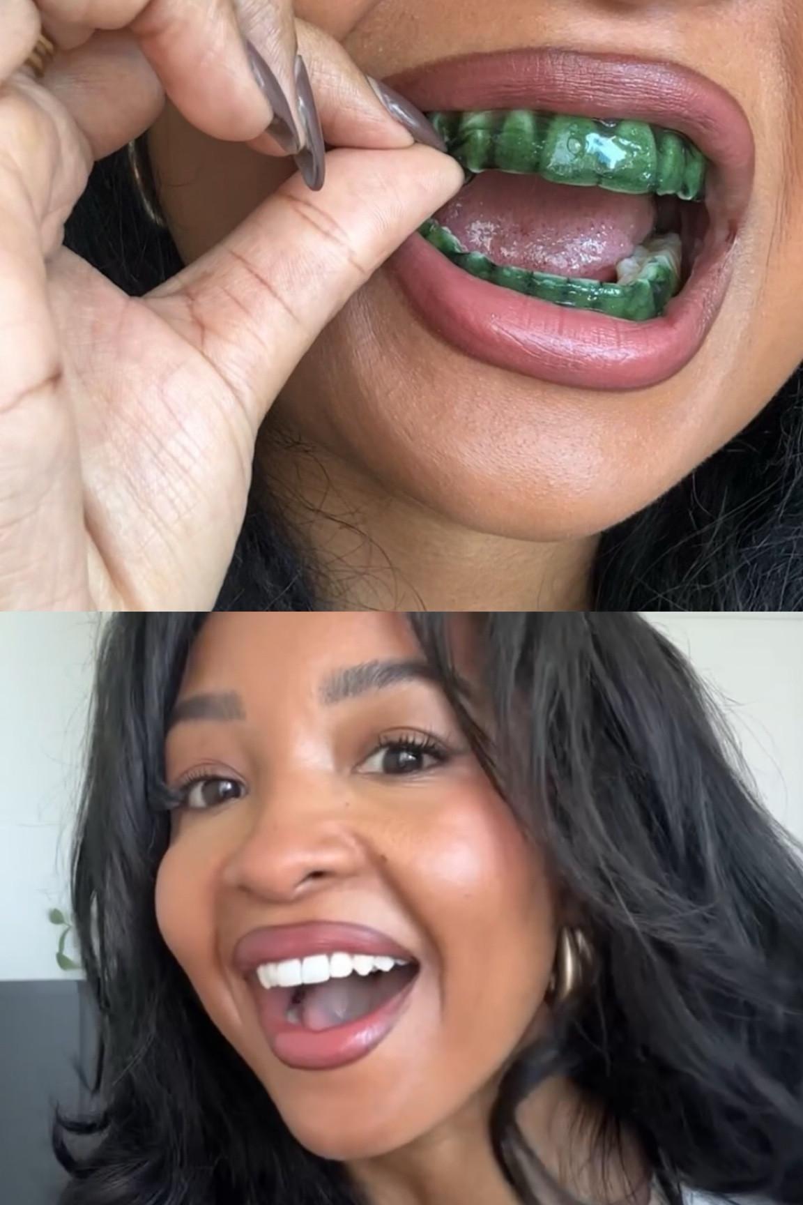 Amazon teeth whitening strips that visibly work in just 30 minutes! 🦷✨

#LTKBeauty #LTKFindsUnder50