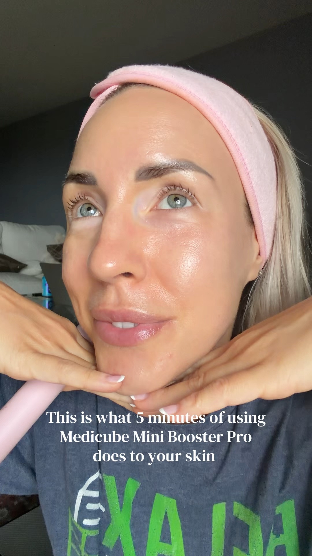 5 minutes with my Medicube Mini Booster Pro and my skin looks absolutely flawless and I genuinely cannot believe these are my results 👀🌸#LTKwellness #Medicube #MedicubeBoosterPro #SkincareResults

#LTKBeauty #LTKootd #LTKBeauty #LTKselfcare