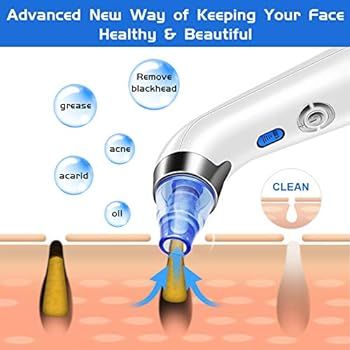Blackhead Remover Vacuum, POPPYO Blackhead Pore Vacuum, Electric Facial Blackhead & Blemish Remov... | Amazon (US)