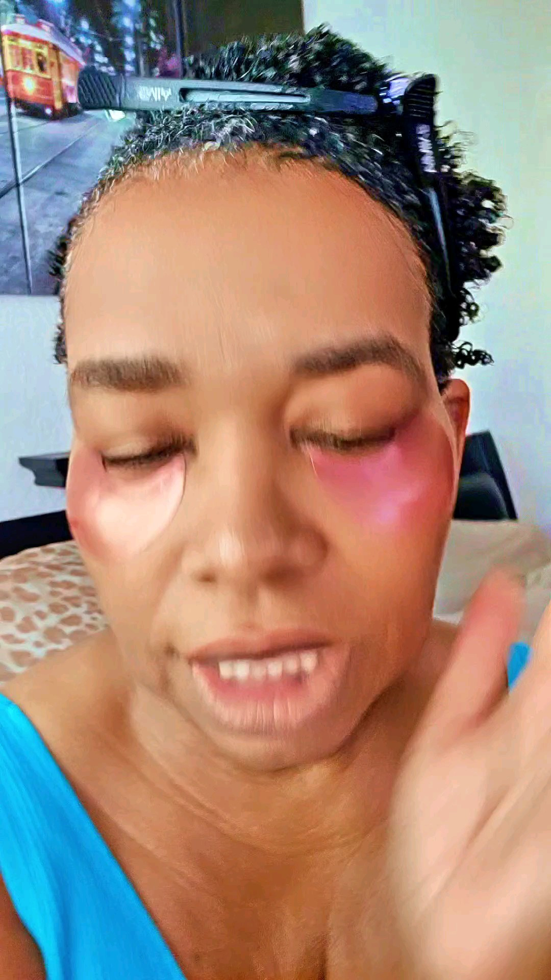 DRMTLGY Brightening Eye Masks (30 Pairs) - Caffeine Eye Masks for Dark Circles and Puffiness with Hyaluronic Acid #brighteningeyemask #caffeine #caffeineeyemasks #undereyebags #undereyecircles #undereye #darkcircles #undereyepuffiness 

#LTKOver40 #LTKFindsUnder100 #LTKBeauty