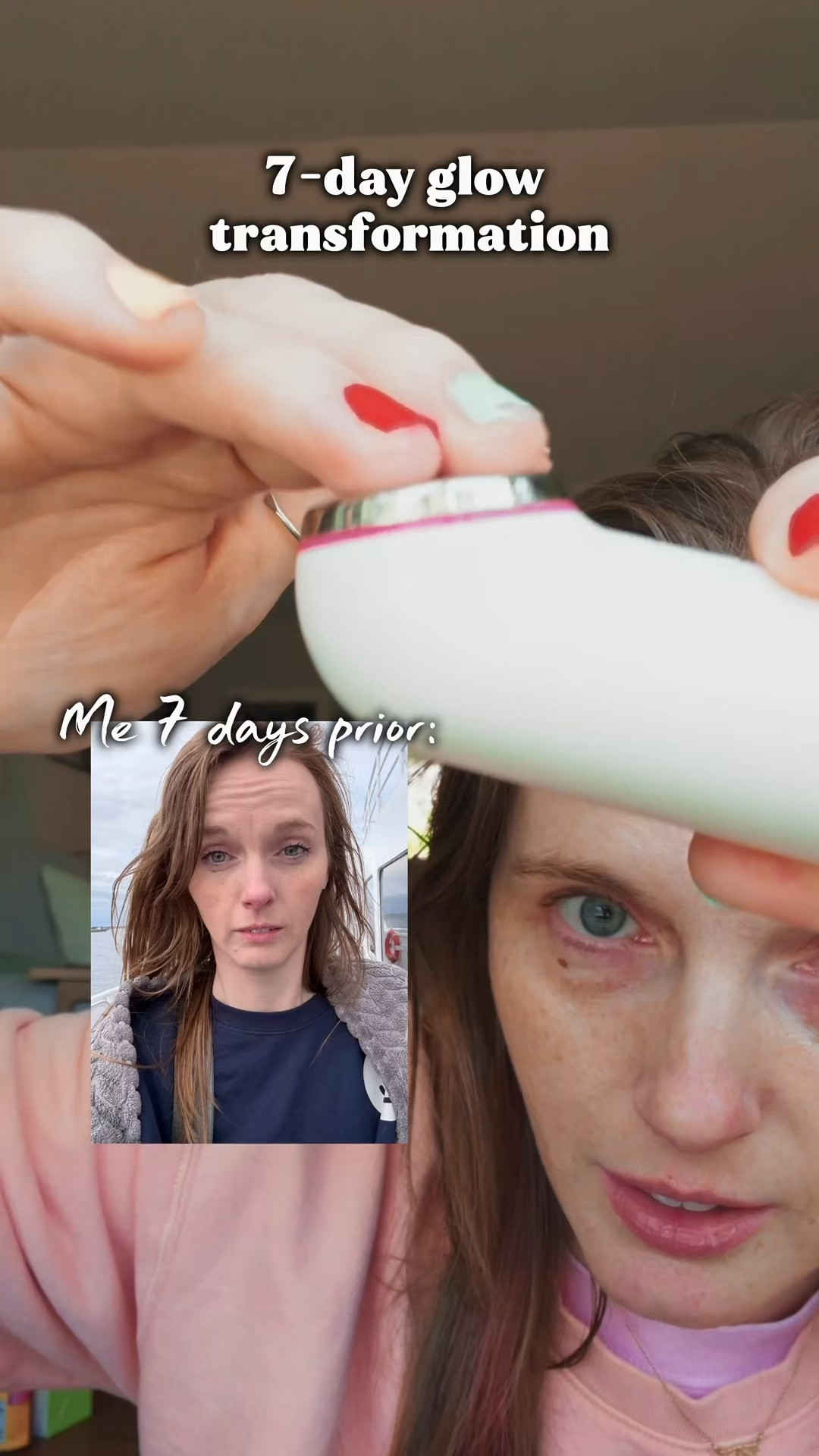 This new Korean facial device takes skin care to a whole Nother level! Who knew you can have skin care with an ultrasound device essentially. I love that this facial device also has three different modes, depending on what kind of work you wanna do and with your face. My personal favorite is the blue feature to support that glow #thome #koreanskincare #facialdevice #facialbeautydevice #antiagingskincareroutine

#LTKSaleAlert #LTKBeauty #LTKselfcare