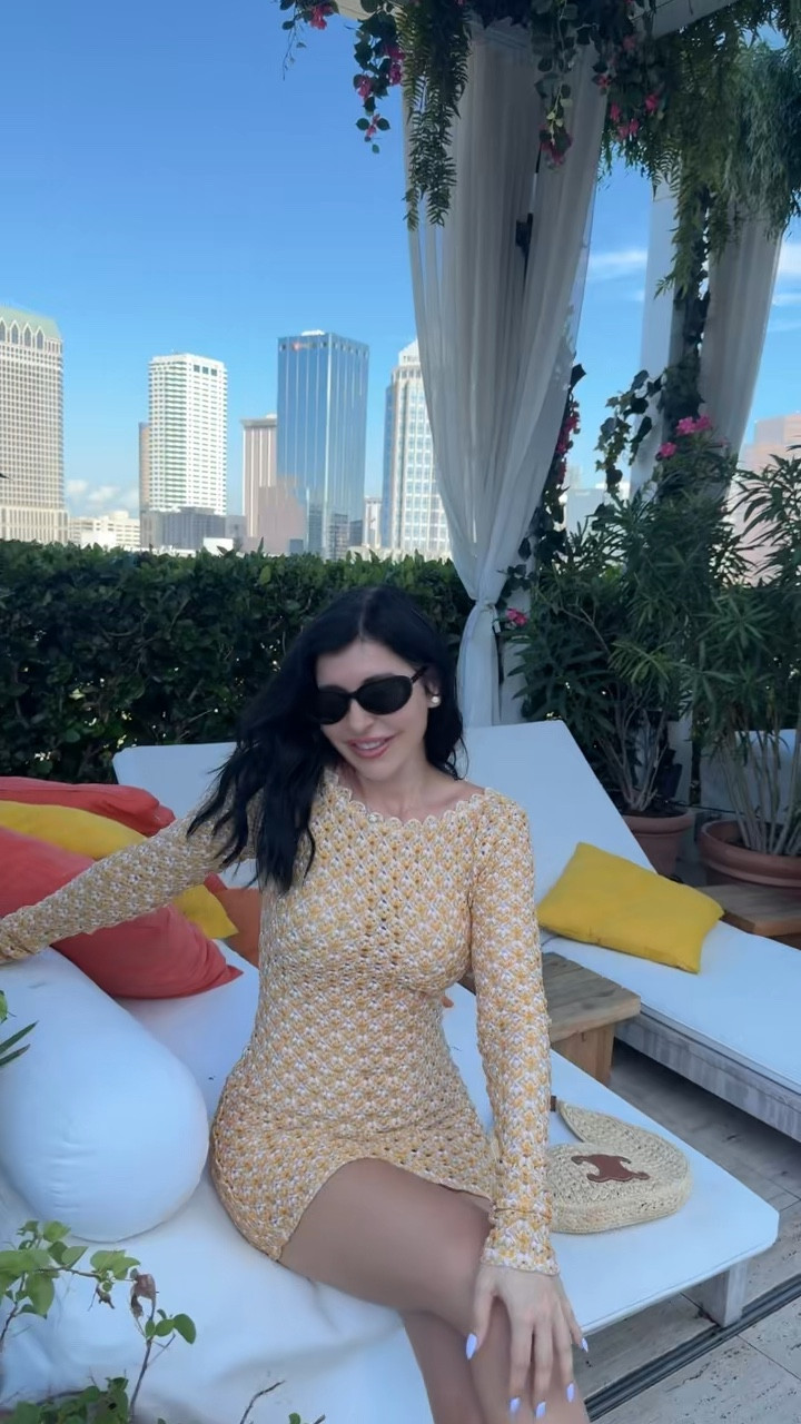 Yellow missoni short coverup mini dress 💛

#LTKParties #LTKSwim #LTKStyleTip