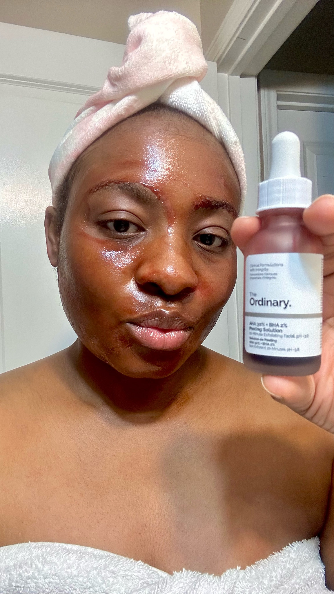 I get asked often what my skincare essentials are. Apart from using face mask and sheet mask, my go to skin care brand is The Ordinary. One of the many reasons I love this brand is how they have a wide variety of products to address different skin issues. Besides, the products are very effective and the price range is super affordable too. I have tagged a couple of the products I already use and added a few extra that I believe you will love. I will also be updating the list as soon as I try something new that works from their collection so be sure to check back! Do bear in mind that different skin types require different regimen, these ones tagged are mainly for all skin types but be sure to also look through their website to see which products suits you best! Also comment below if you are a fan of The Ordinary already or looking to try out their products. Do recommend other products not tagged here that you think I can try too, let’s help each other achieve radiant glowing skin that we all deserve! Xoxo 😘 

#LTKFindsUnder50 #LTKBeauty #LTKxelfCosmetics