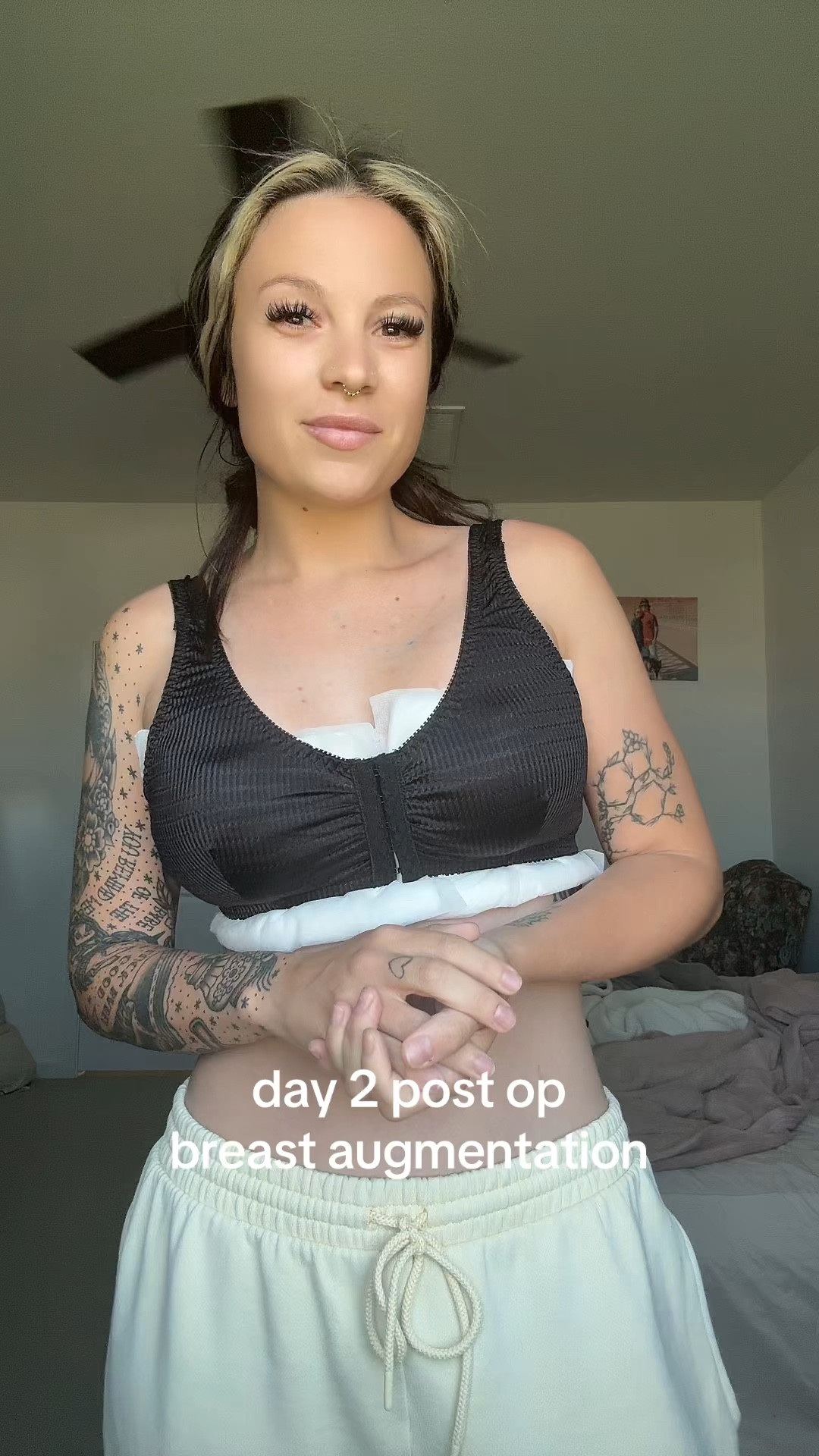 day 2 post op — breast augmentation surgery 

#LTKdayinmylife #LTKselfcare #LTKmomlife