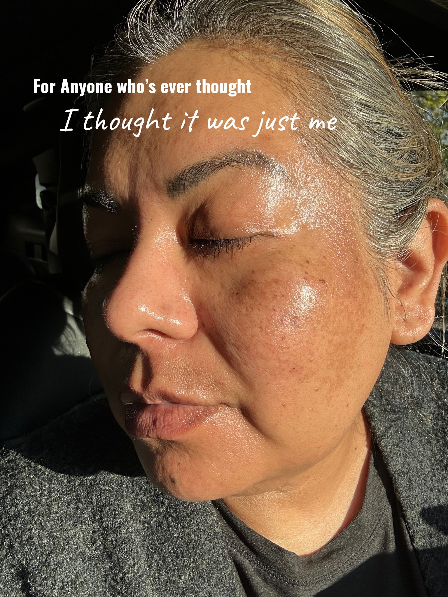 Melasma in real light. No filter. No apology. 

These are the products I actually use and trust for pigment support, not because they erased my melasma (nothing does that overnight), but because they make a consistent, visible difference over time.
Trends are fast. Pigment is stubborn. I choose accordingly.
👇 Shop my melasma-aware routine

#LTKBeauty
