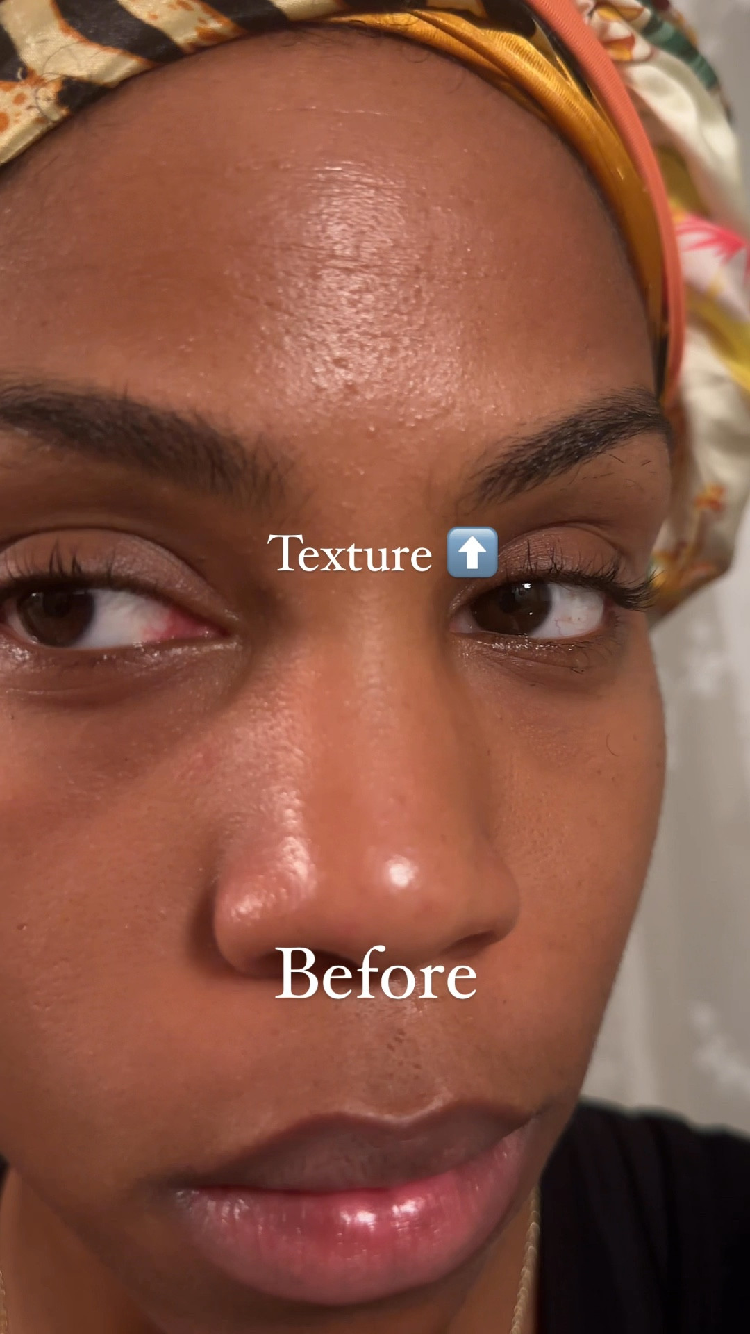 I recently started using Paula’s Choice 2% BHA Liquid Exfoliant and it single handedly gets rid of the texture from clogged pores I get on my forehead. Like every single time. I’ve been using 3-4 times a week so that my skin doesn’t dry out and I’ve seen such a huge improvement! Highly recommend if you’ve got texture! 

#gifted #PaulasChoice #skincare #texturedskin

#LTKBeauty