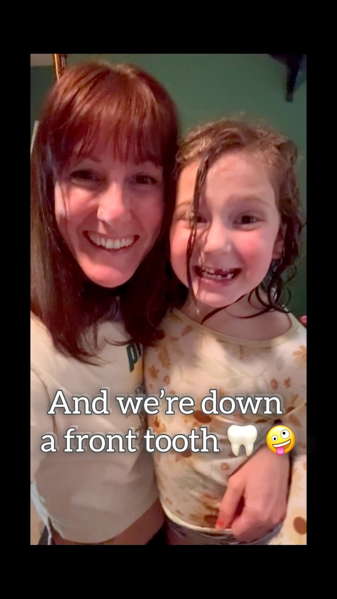 How do you help your children’s teeth 🦷 evacuate the premises? 🤗🧐🤷🏻‍♀️😂

#LTKmomlife #LTKKids #LTKdayinmylife
