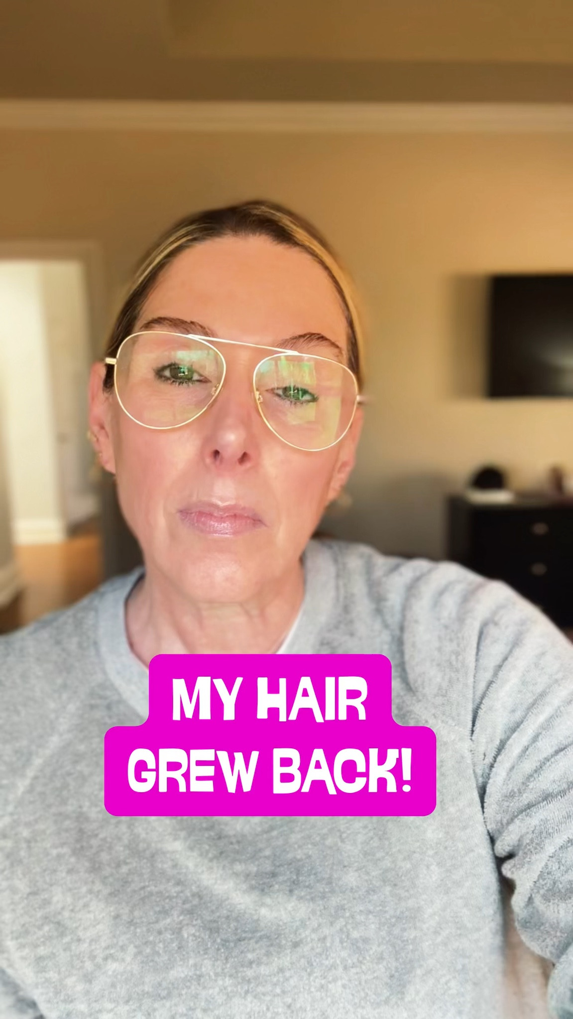 The one thing I wasn't ready to lose in my 50s. Let’s get real—menopause and aging did a number on my hair density. For a while, I just wore hats and hoped nobody noticed. But I decided to stop hiding and start treating.

It took patience (and the right routine), but the regrowth is real, and the confidence is back! ✨ 

I’ve linked the exact combo that actually moved the needle for me. It’s never too late to invest in yourself. 🤍 

#LTKOver40 #LTKselfcare #LTKvlog