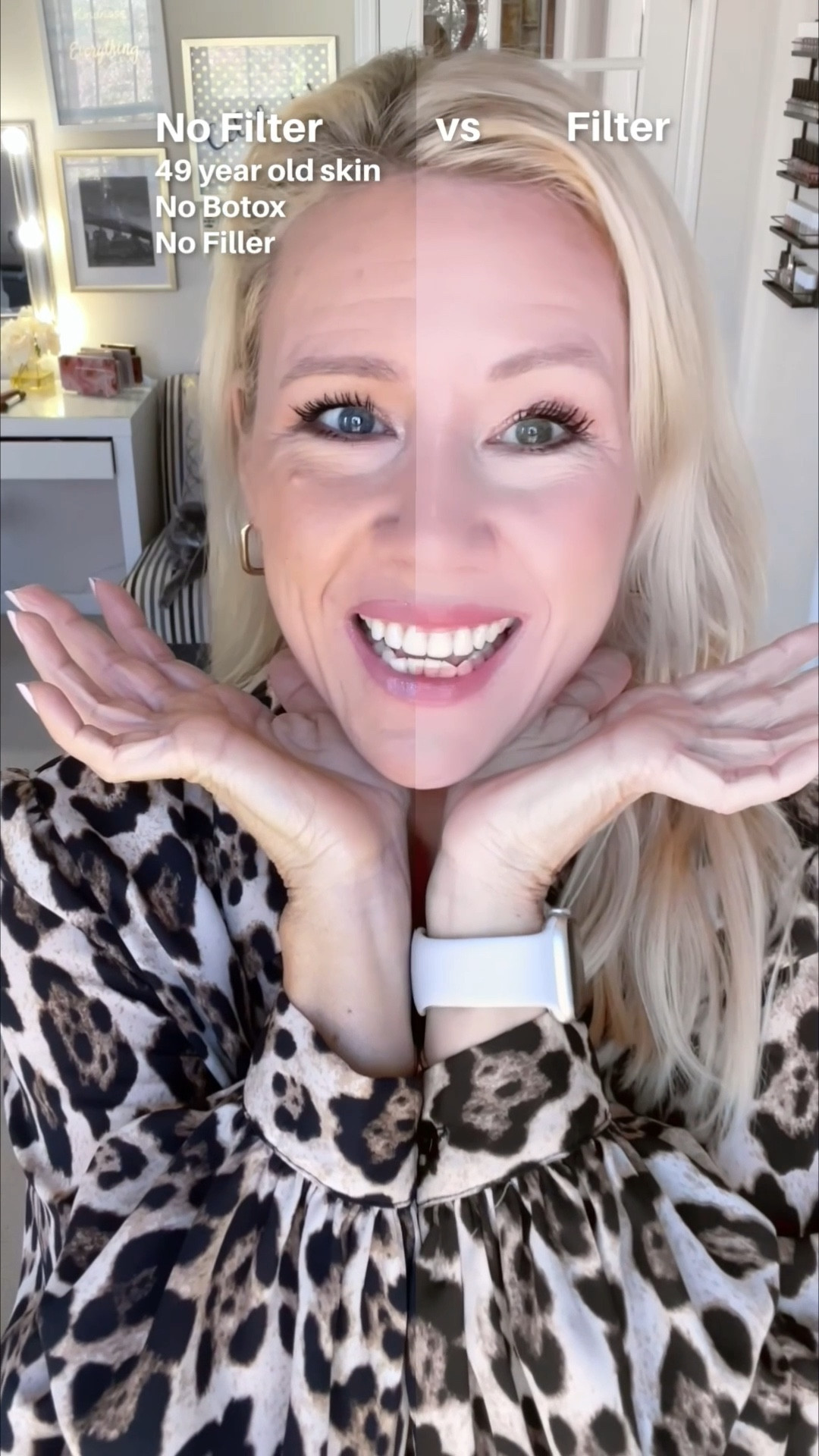 Just a little reminder that a lot of what we see on social media isn’t real. I can totally understand why creators choose to use filters though! Every time I show my bare face without any makeup, people are recommending to me all kind of cosmetic procedures such as an upper bleph or a facelift and they tell me how ugly I am. You have to have thick skin to show yourself without a filter on social media these days, but I still wish more creators would do that, so that people don’t aspire to unachievable goals that aren’t real! Remember that: skin texture, pores, wrinkles- all that is normal stuff. We all have it!!! 

#LTKOver40 #LTKBeauty