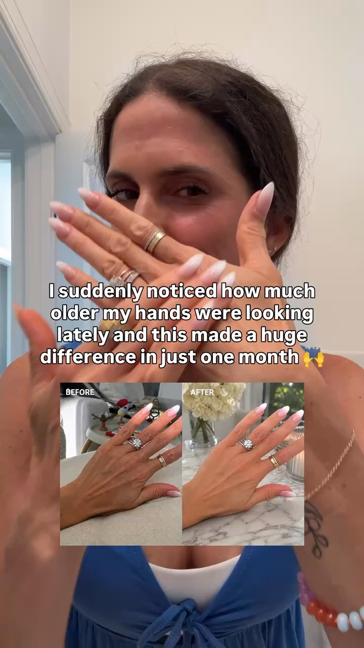One of my favorite beauty finds lately for smoother, more hydrated looking hands. The difference after consistent use surprised me.

#LTKSeasonal #LTKmomlife #LTKootd