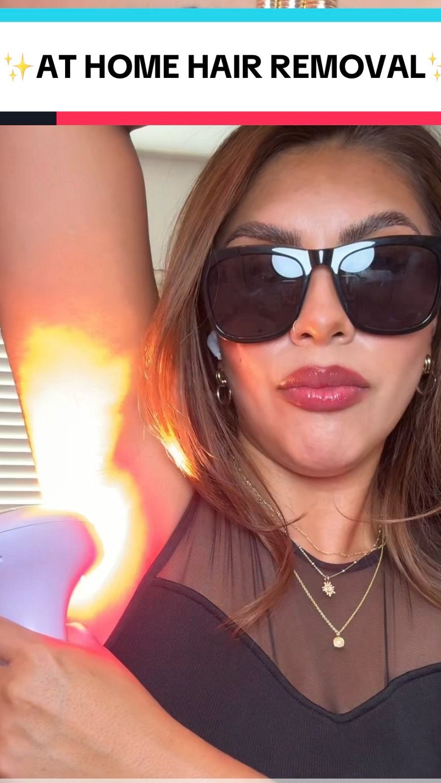 Skip the appointments and go hair-free at home with the @Michael Todd Beauty Lumos IPL Hair Removal Device💡 Clinically proven results, minimal effort, and zero irritation. Smooth skin has never been this easy. Shop now on my LTK! 💖#michaeltoddbeauty #verifiedreview #summerbeautyessentials #beautyessentials #glowingskin 

#LTKBeauty #LTKGiftGuide #LTKHoliday