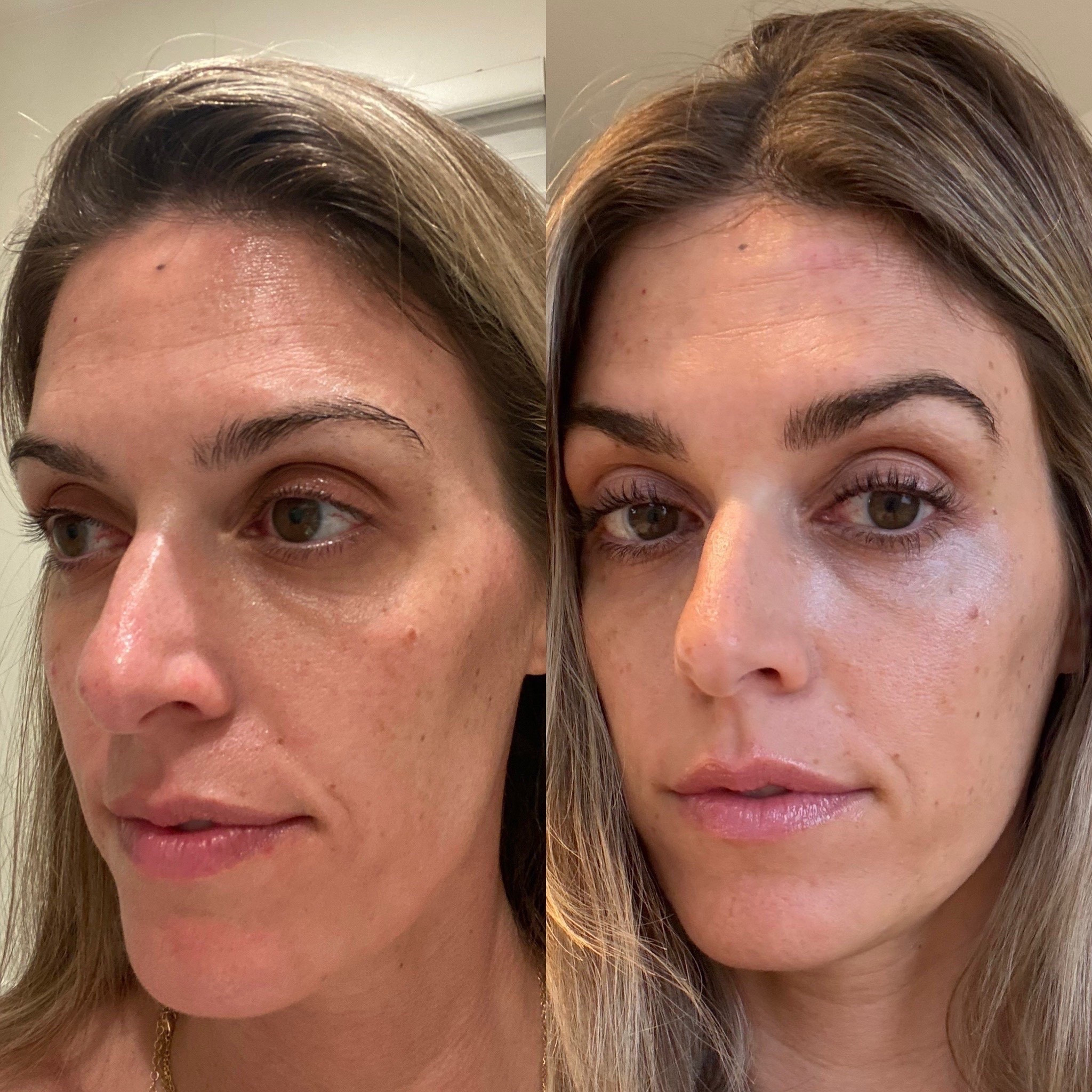 Grab the serum that changed my lashes, 25% off today! I use their brow serum as well 👌🏻 It’s been almost two years since I started using it and it has totally transformed my lashes and eyebrows! I use it at night before bed and noticed a real difference after 4-6 weeks of using it. 

Babe Original, eyelash serum, eyebrow serum, beauty must haves, nighttime routine, makeup routine, get ready with me

#LTKgrwm #LTKBeauty #LTKSaleAlert