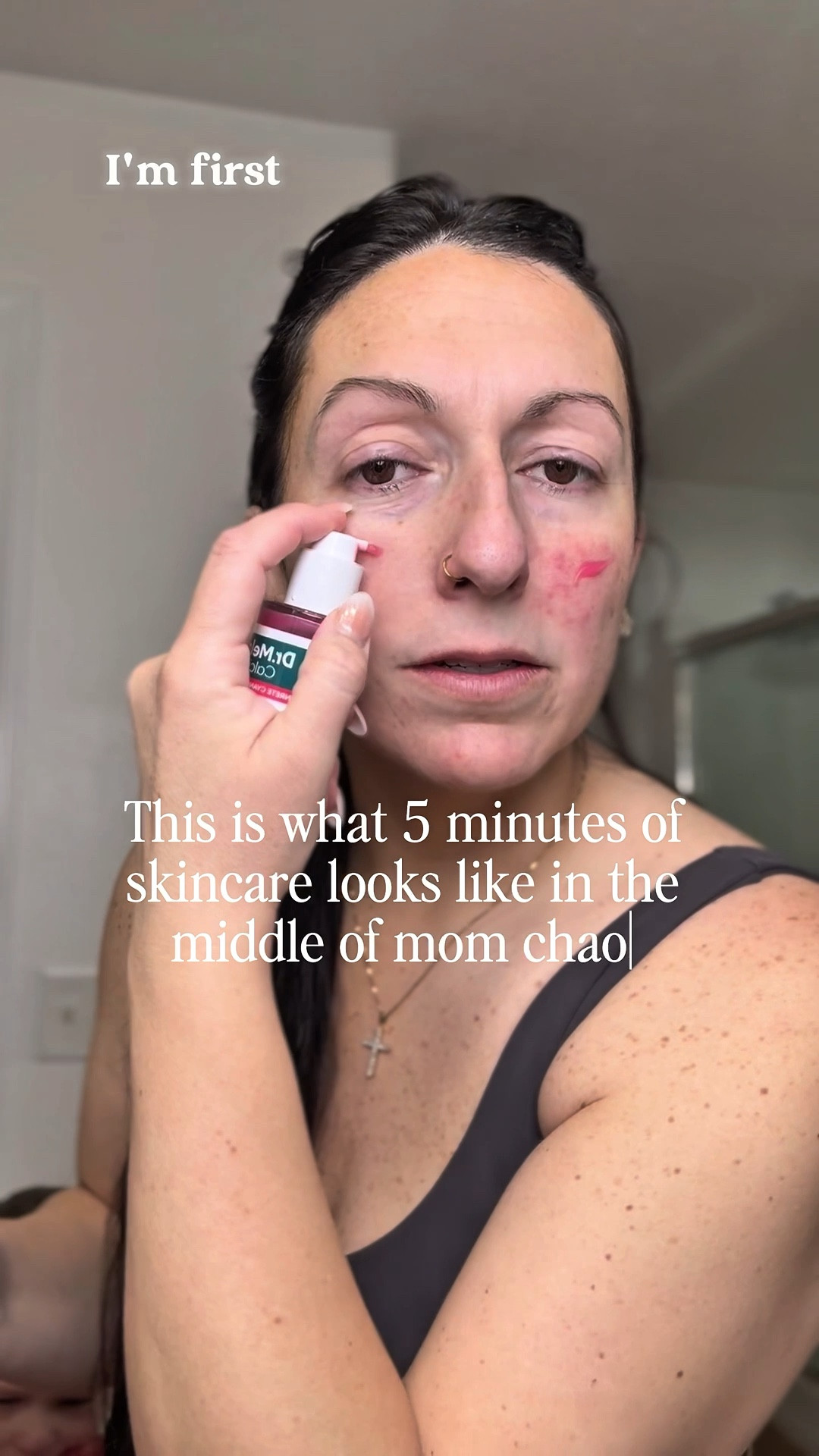 Why Korean skincare works so well:
✔️ Skin-first ingredients
✔️ Proven formulas
✔️ No fluff
Why I grabbed this bundle:
75% OFF and my skin looks unreal.
Run—this deal won’t last. 🏃‍♀️💨


#LTKBeauty #LTKgrwm #LTKmorningroutine