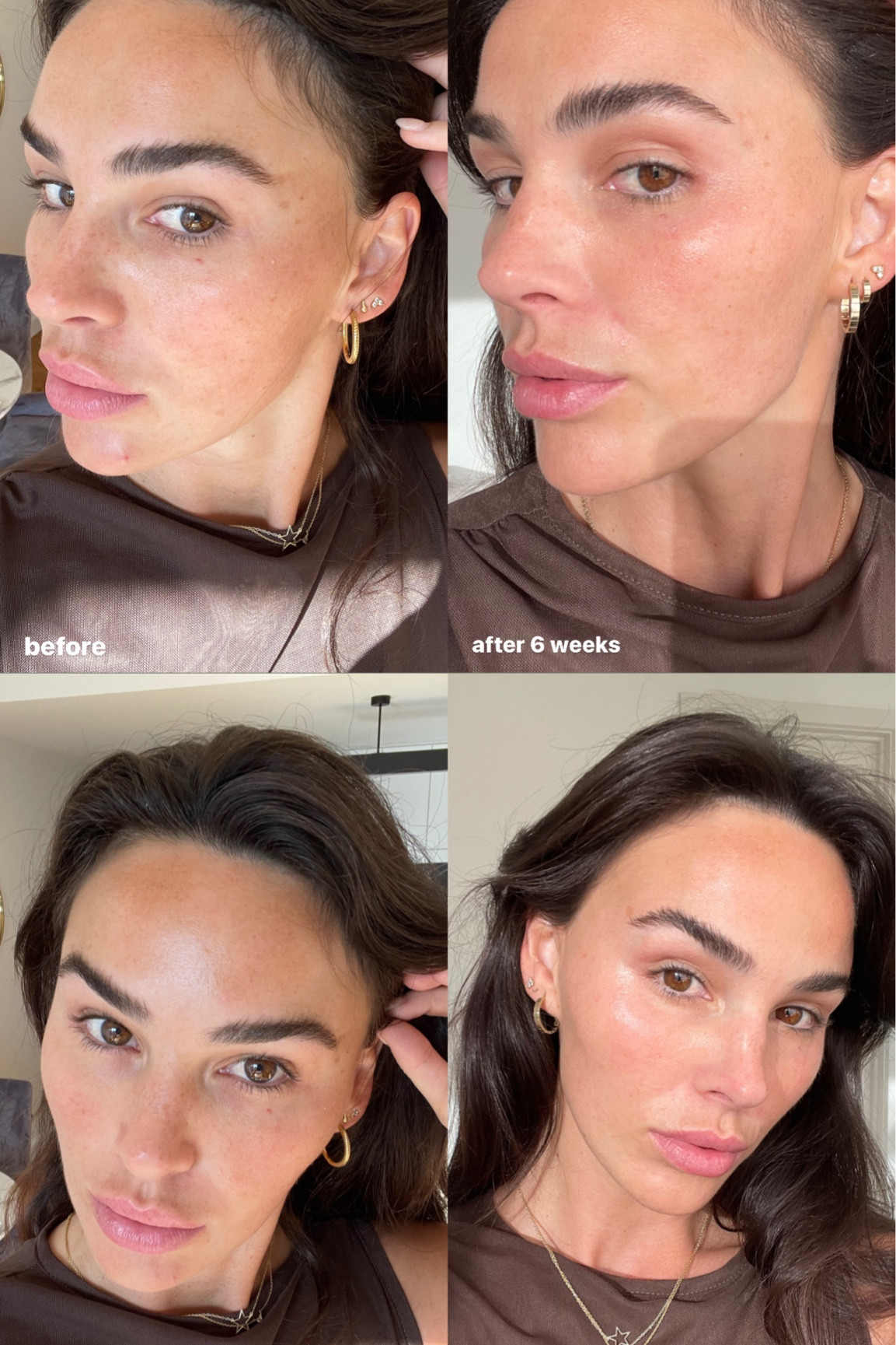 This serum has changed my skin dramatically- targets pigmentation like never before. Obsessed with it- La Roche Posays MelaB3