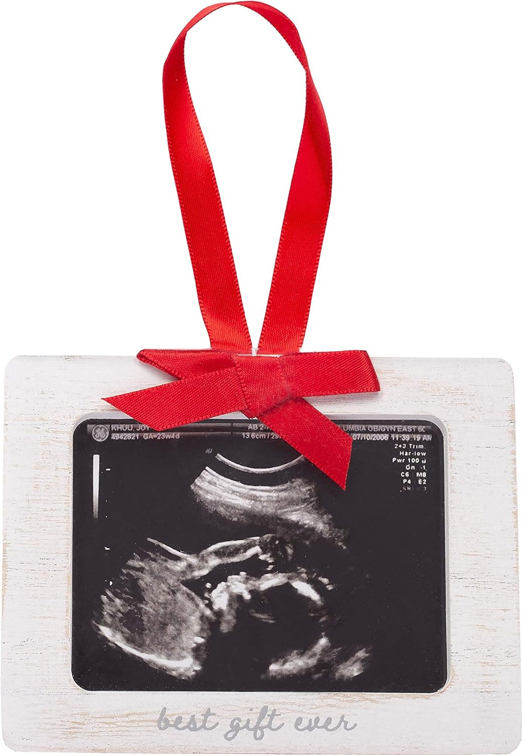 Pearhead Sonogram Picture Ornament, Best Gift Ever Baby Ornament, Gift for Expecting Parents, Ultras | Amazon (US)