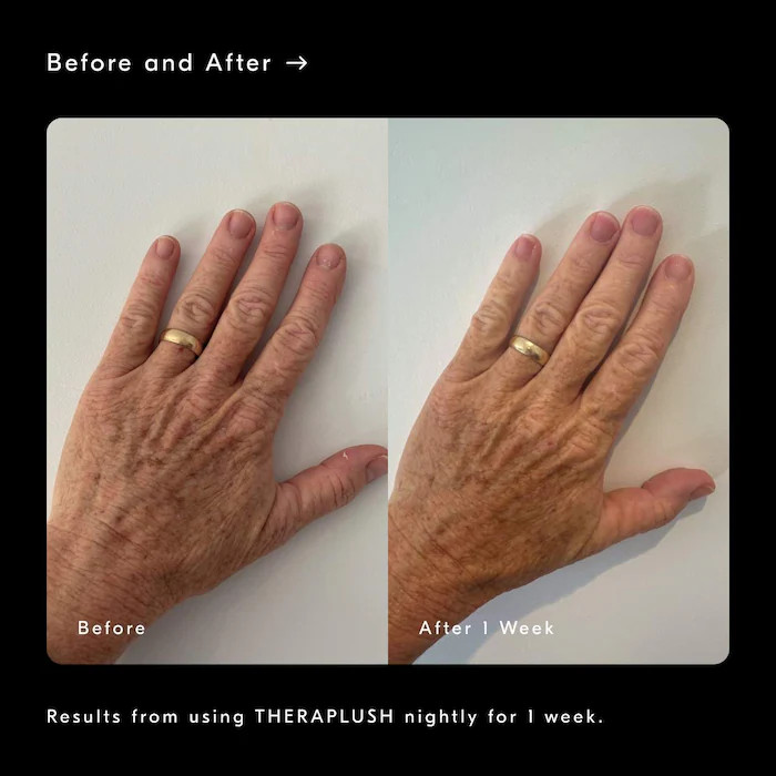 Theraplush “Hold” Refillable Overnight Retinol Hand Repair Cream | Sephora (US)
