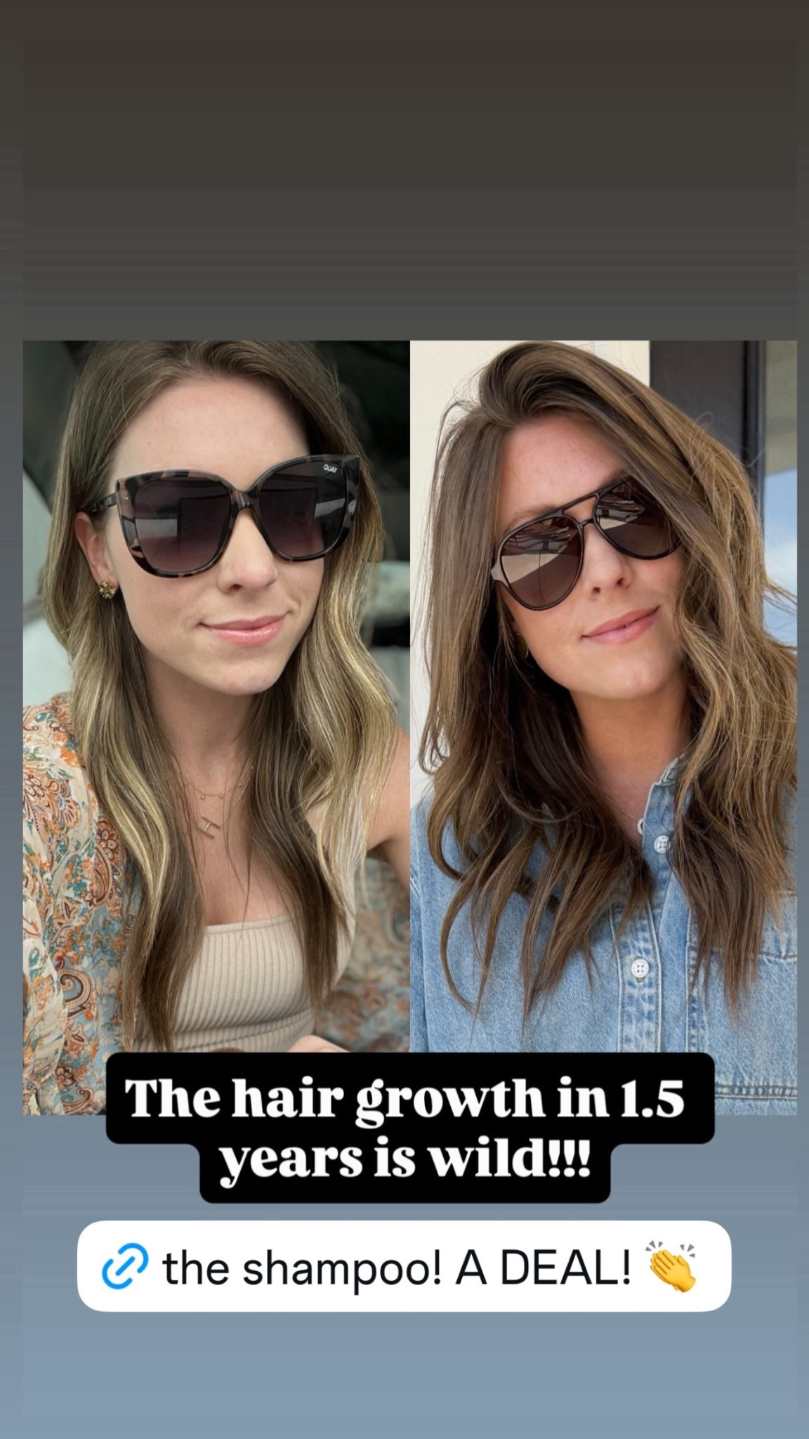 The hair growth from this shampoo is insane! On sale for AMAZON prime day!

#LTKselfcare #LTKSaleAlert #LTKBeauty