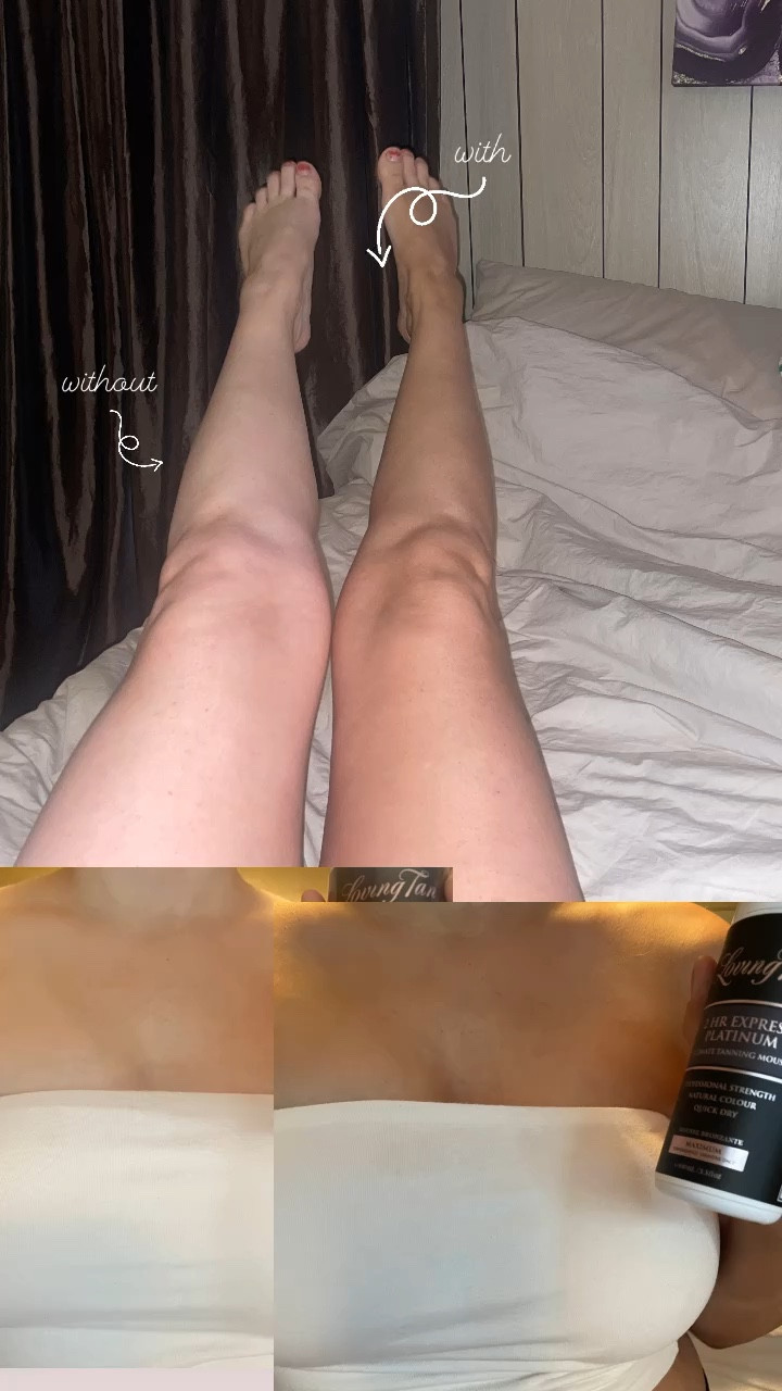 This is still so crazy to me. With & without. Worth every penny. I will never use another tanner! #tan ✨

#LTKBeauty #LTKFindsUnder100 #LTKGiftGuide