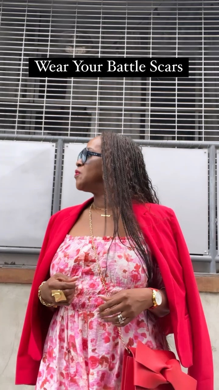 •| SHOW LIFE’S BATTLE SCARS |• With a badge of honor. 
.
.
Sometimes talk can be cheap. The question is, am I living like I say I am?
.
.
When I first got braids after having brain surgery I didn’t want to wear my hair up because I wanted to avoid someone randomly asking me, “how did you get that scar on your head?” It wasn’t really until I watched an episode of the @jenniferhudsonshow where an audience member gladly showed off an outfit and her beautiful legs with a big long scar. She said something like, this scar reminds me that I almost lost my life so I show it off proudly!” LESSON! 
.
.
Don’t just talk about it…be about it! 
.
.
Your story is a testimony that can help others! Wear your battle scars proudly!
.
.
Dress @hm 
Earrings @itsallculture_statementjewelry 
Jacket @jcpenney 
Sunnies @elisajohnson.co 
Bag @sabrakboutique 
Watch @talleyandtwine 
Bracelet @annexjoseph 
 Necklaces @amazonfashion 
.
#warrior #mentalhealthawarenessmonth #braintumorsurvivor #faithandfashion #midlifeinfluencer #colorfulstyle #stylishparadox

#LTKstyletip #LTKSeasonal #LTKcurves