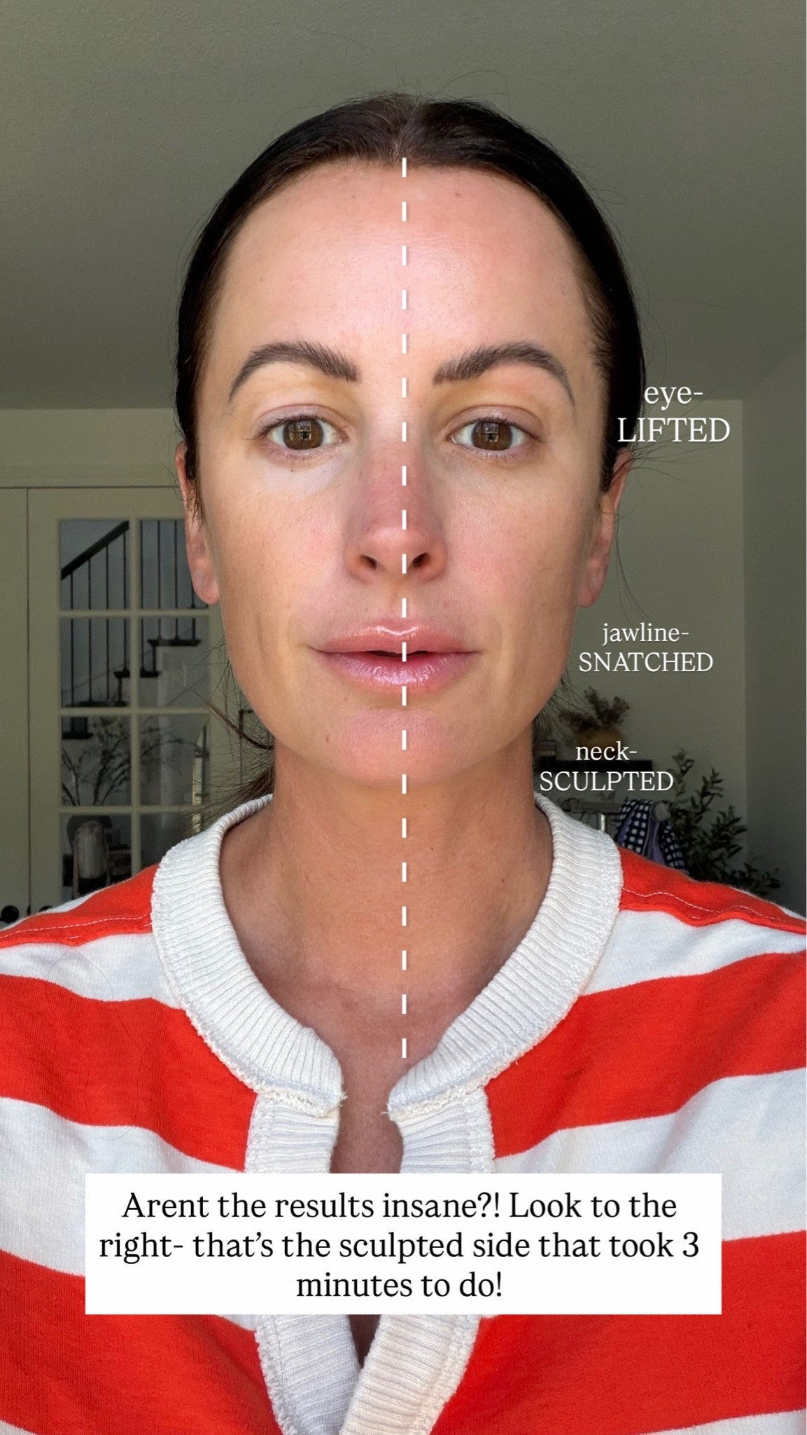 These results are insane!! This tool made my face look so much more snatched and defined! Currently on sale with code: BEAUTY20

#LTKgrwm #LTKselfcare #LTKBeauty

#LTKSaleAlert #LTKOver40 #LTKmorningroutine