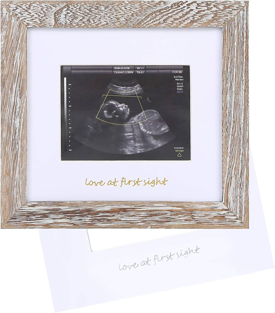 IHEIPYE Baby Love at First Sight Sonogram Keepsake Frame - Ultrasound Picture Frame - Pregnancy A... | Amazon (US)